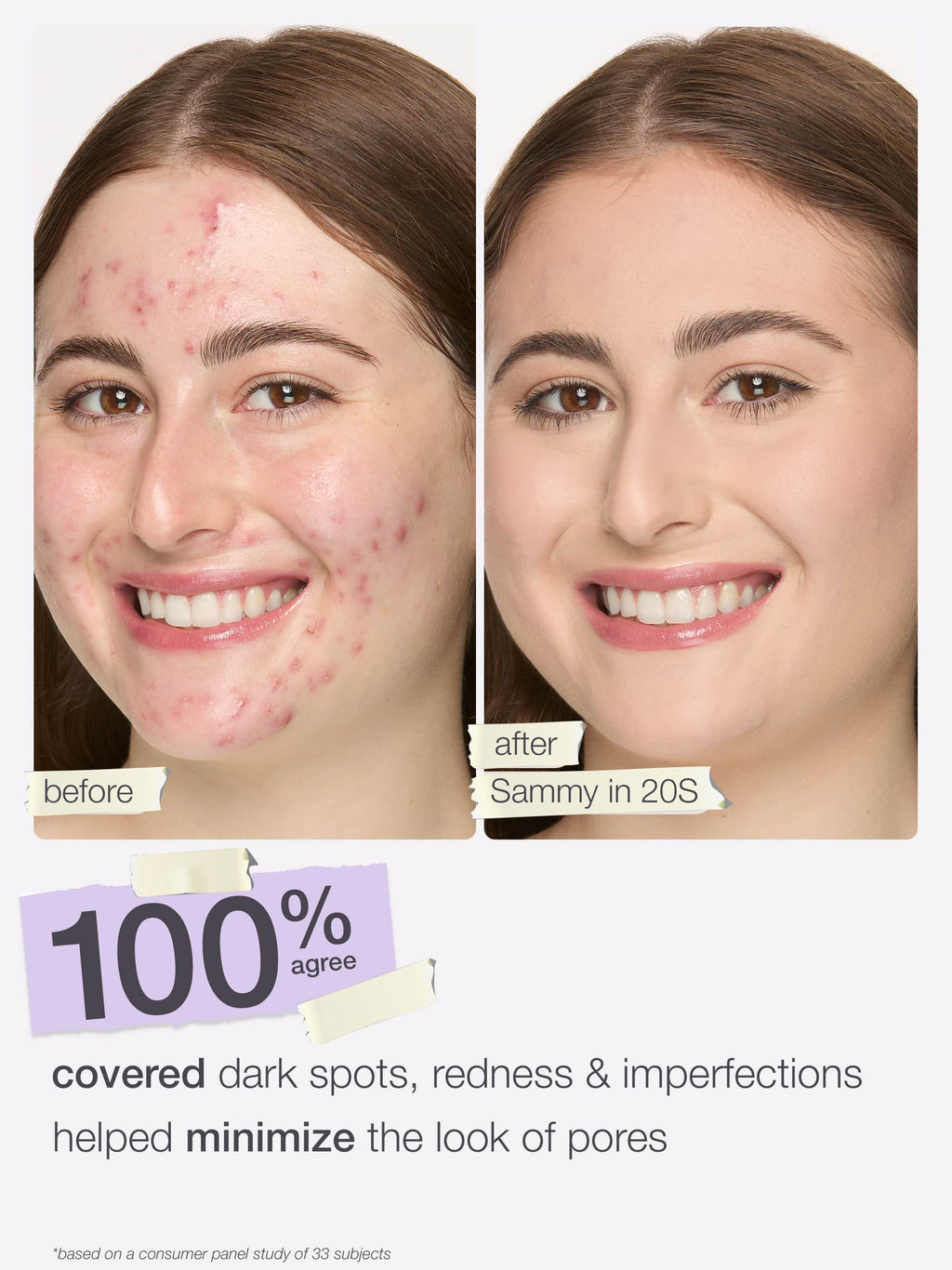 Two side-by-side facial images show a person before and after using Tarte Cosmetics, with evident skin improvement. Text reads: 100% agree covered dark spots, redness & imperfections helped minimize the look of pores.