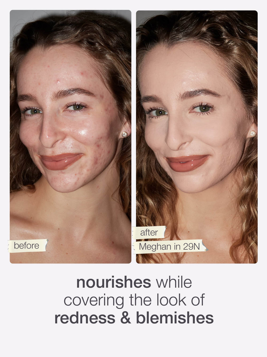 Two side-by-side images show a woman's face before and after makeup application. The before image highlights redness and blemishes, while the after image displays a smooth complexion. Text: before, after Emily in 20B, nourishes while covering the look of redness & blemishes.