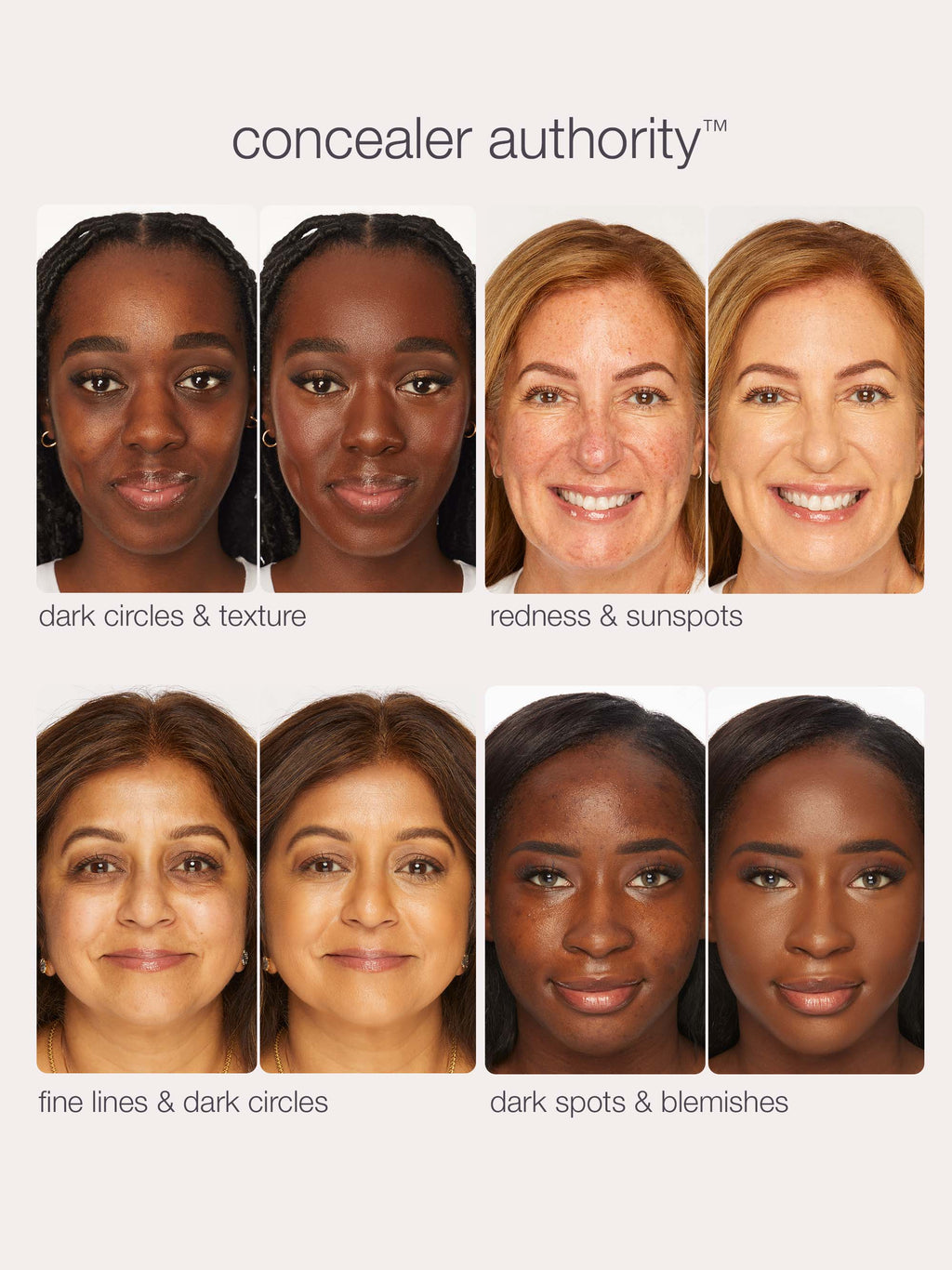 Concealer Authority advertisement showing different skin concerns on faces.
