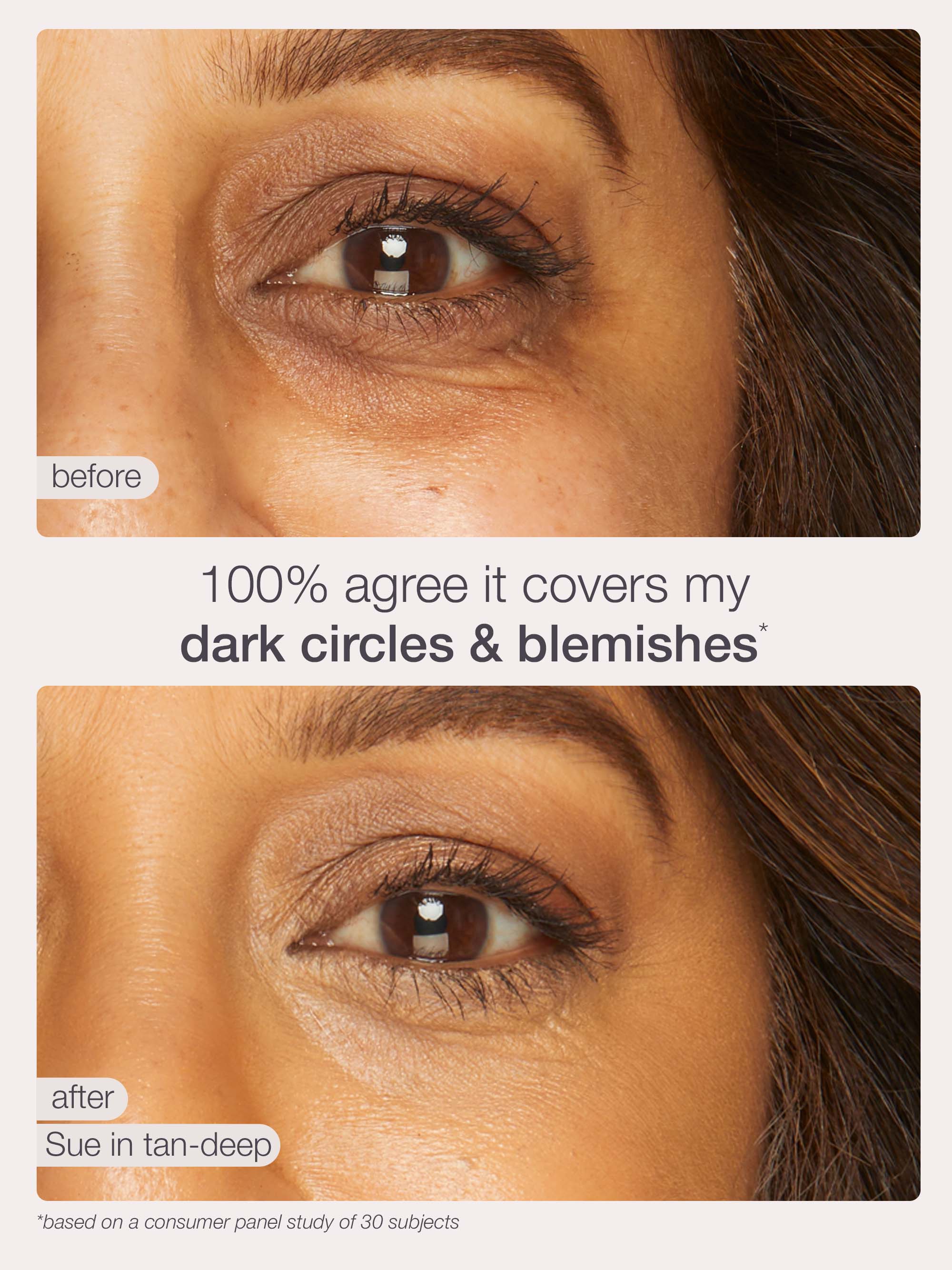 Before and after comparison of eye area with dark circles and blemishes, showing a product's effect.