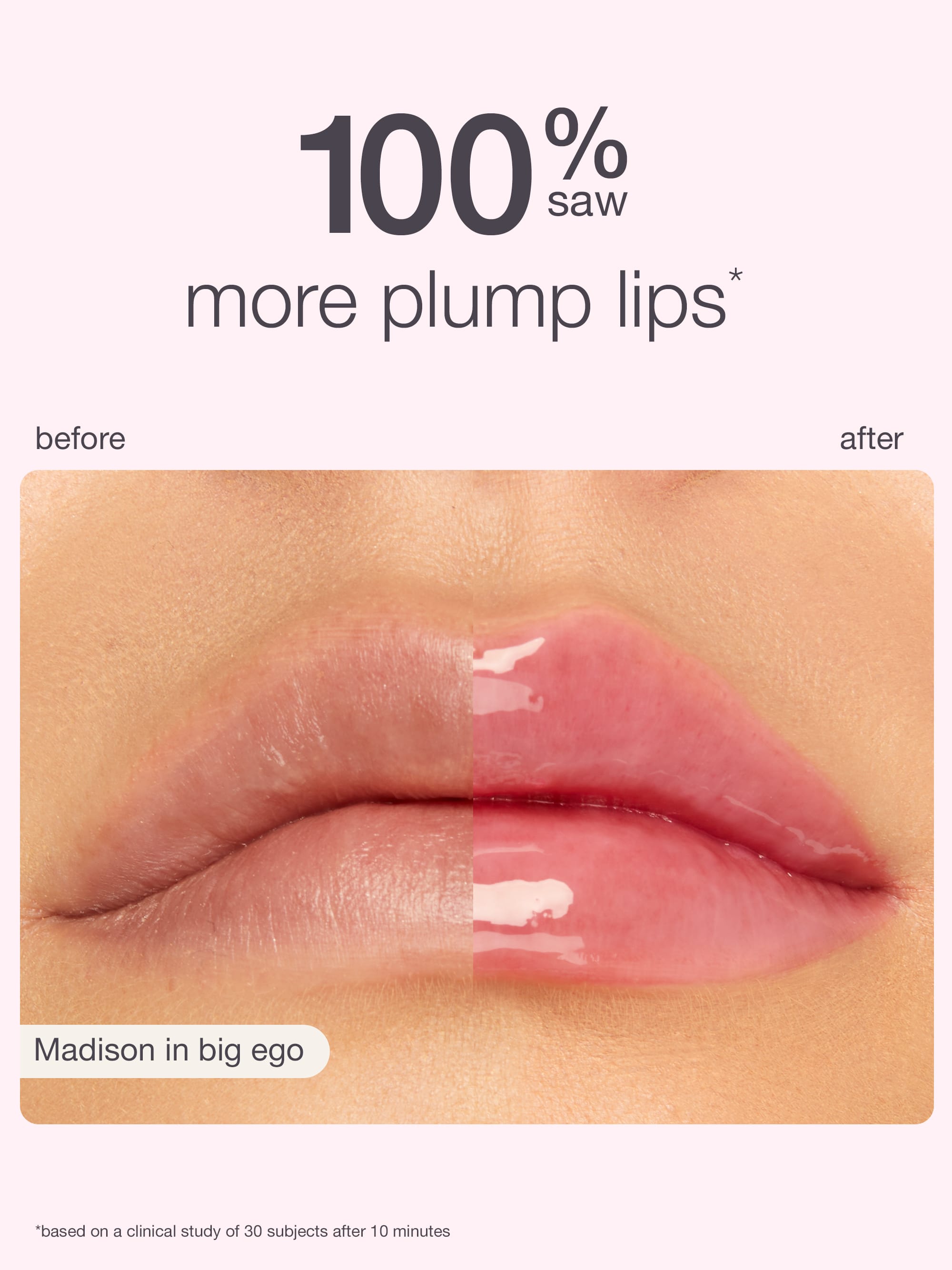 Before and after comparison of plump lips with text indicating product effectiveness.