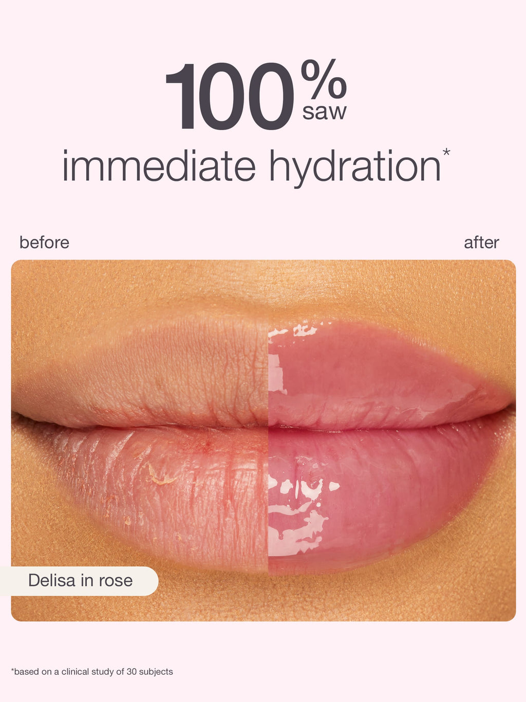 Before and after comparison of lips with immediate hydration, showing a visible improvement in color and texture.