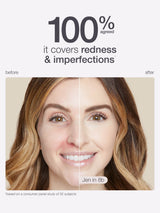 Before and after comparison of a woman's face with text indicating product effectiveness on redness and imperfections.