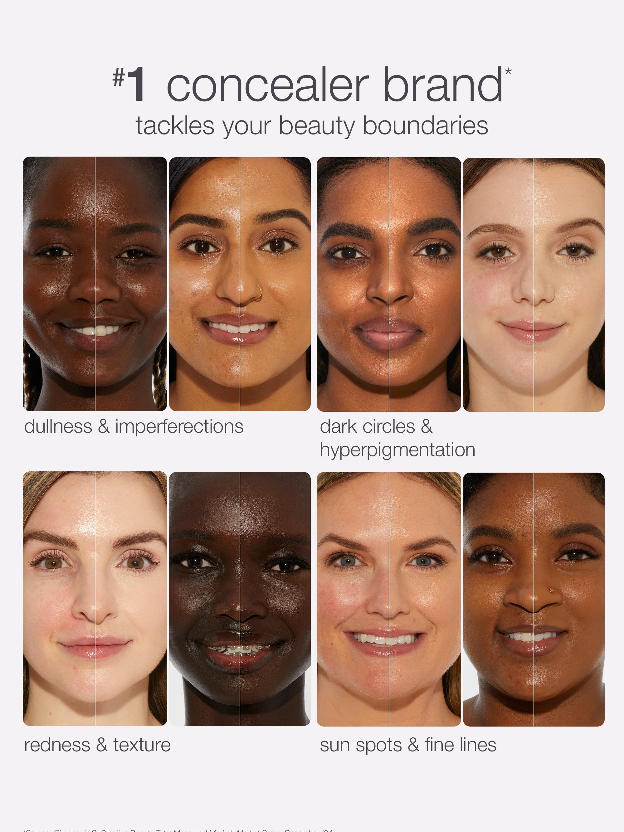 Text reads: 1 concealer brand* tackles your beauty boundaries. Below are eight split-face images showing before and after effects of concealer on different skin issues: dullness & imperfections, dark circles & hyperpigmentation, redness & texture, sun spots & fine lines.