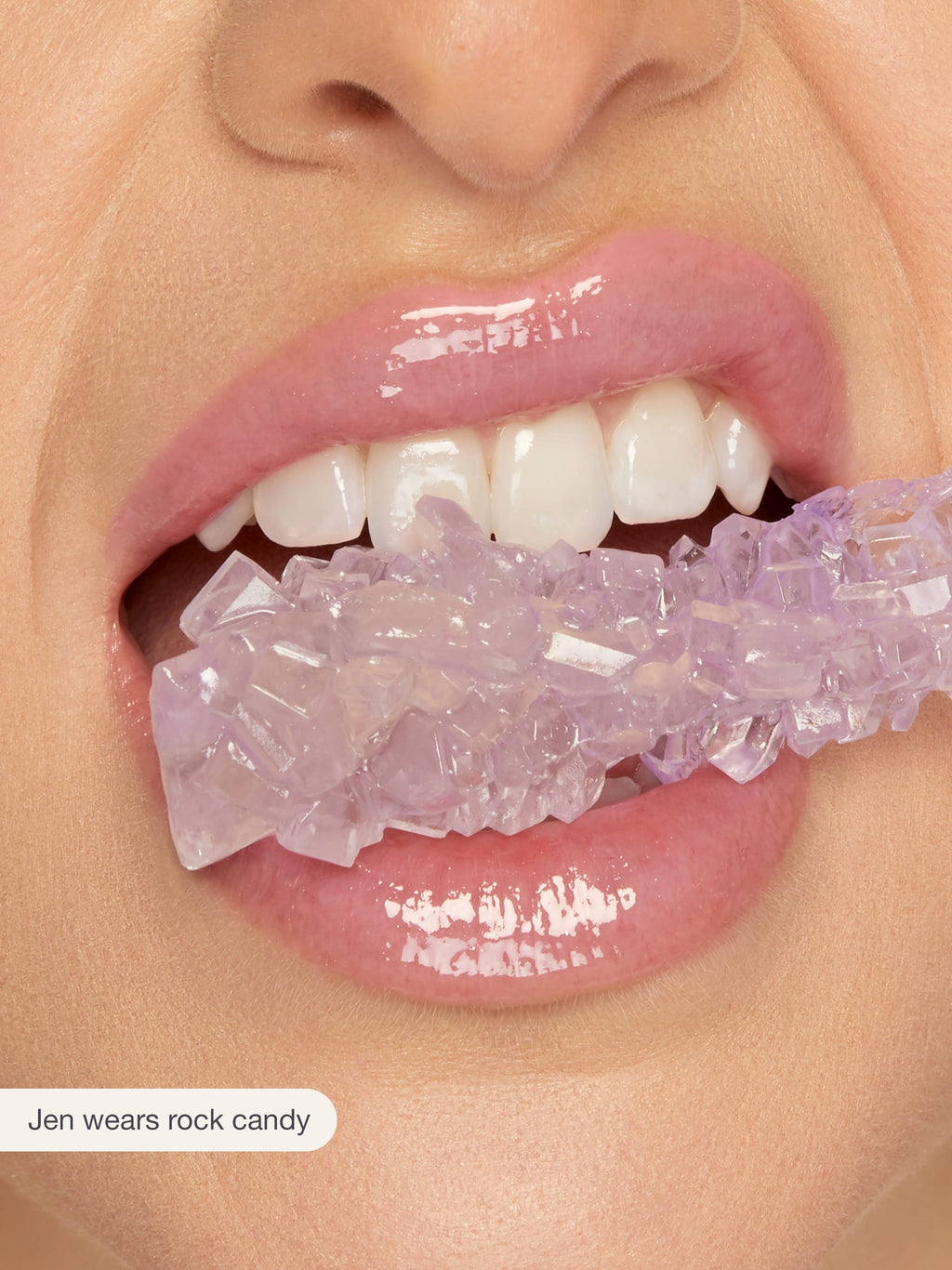 Person wearing a clear aligner with a pink and purple design, labeled 'Jen wears rock candy'.