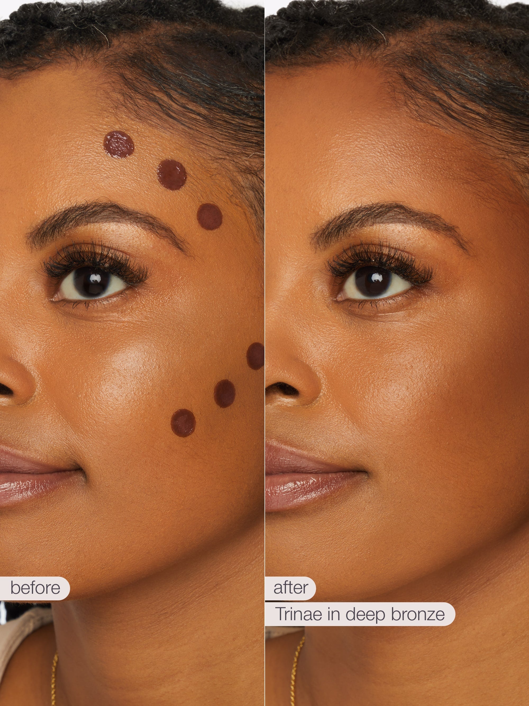 Before and after comparison of a woman's face with blemishes, using a cosmetic product labeled 'Tinieae in deep bronze'.