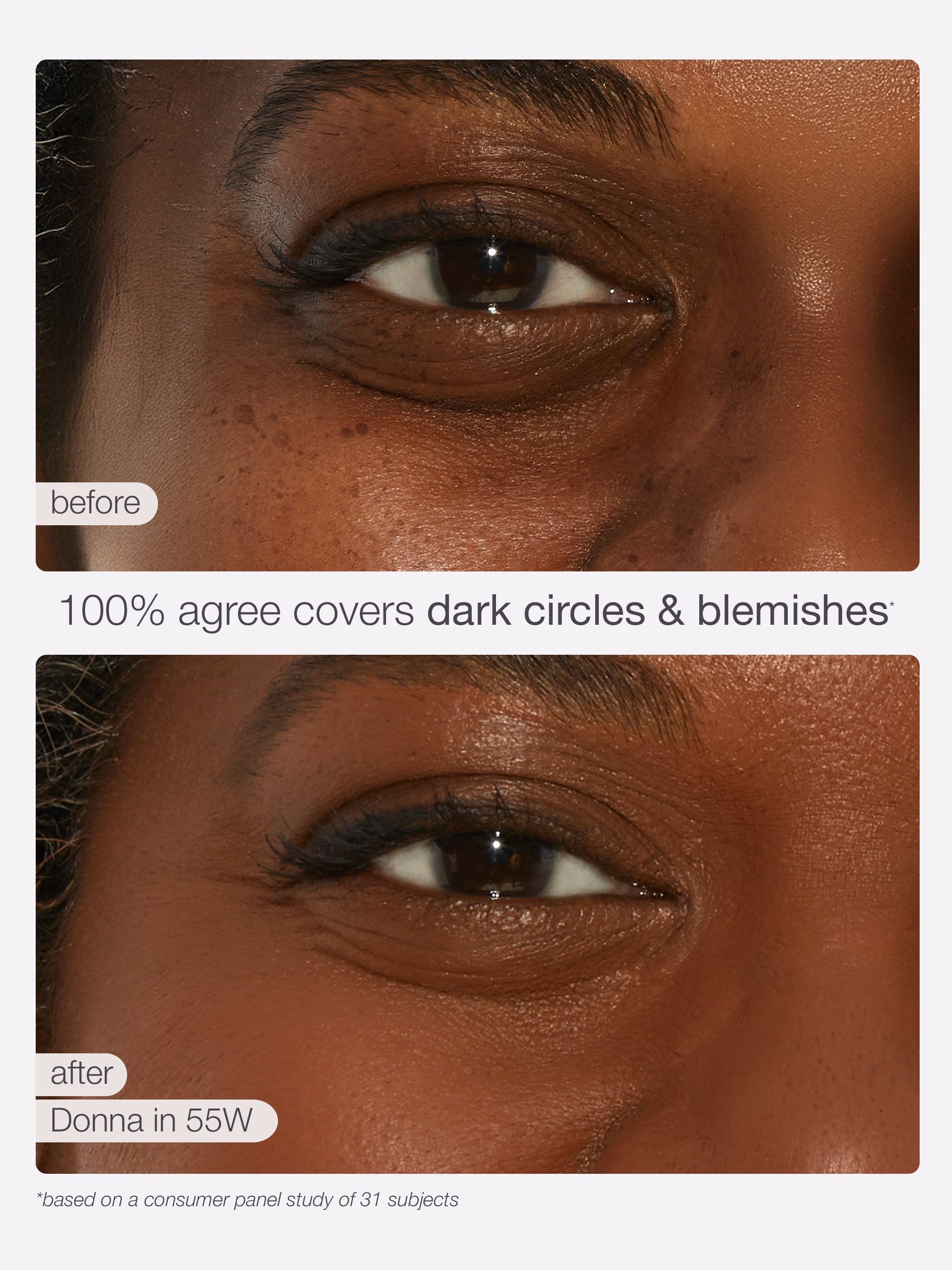 Two close-up images show an eye with visible dark circles and blemishes in the top image, and a concealed, clear complexion in the bottom image. Text: 100% agree covers dark circles & blemishes. Before. After. Based on an instrumental study of 31 subjects.