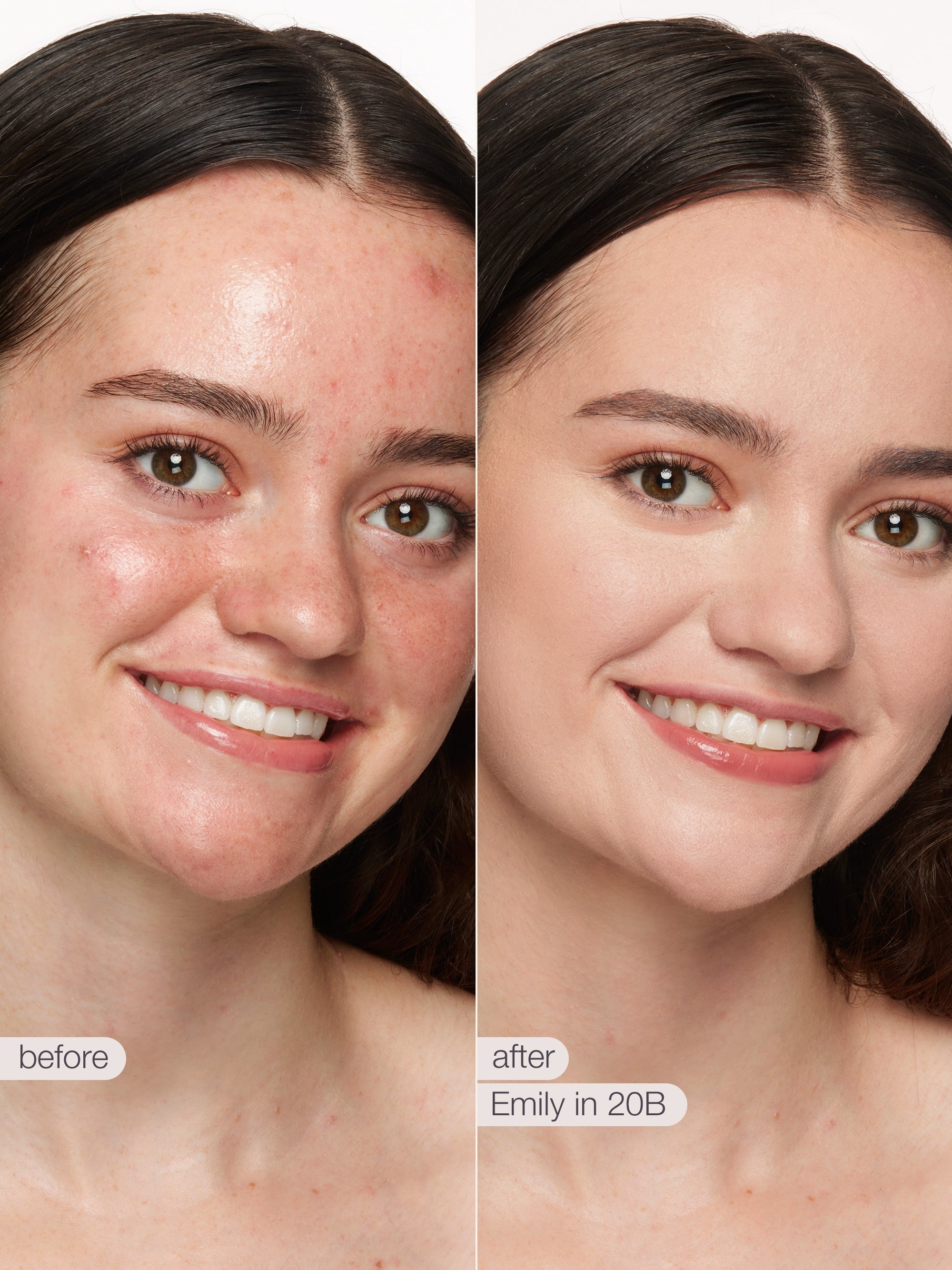 Before and after comparison of a woman's face with visible skin improvement. using tarte shape tape concealer