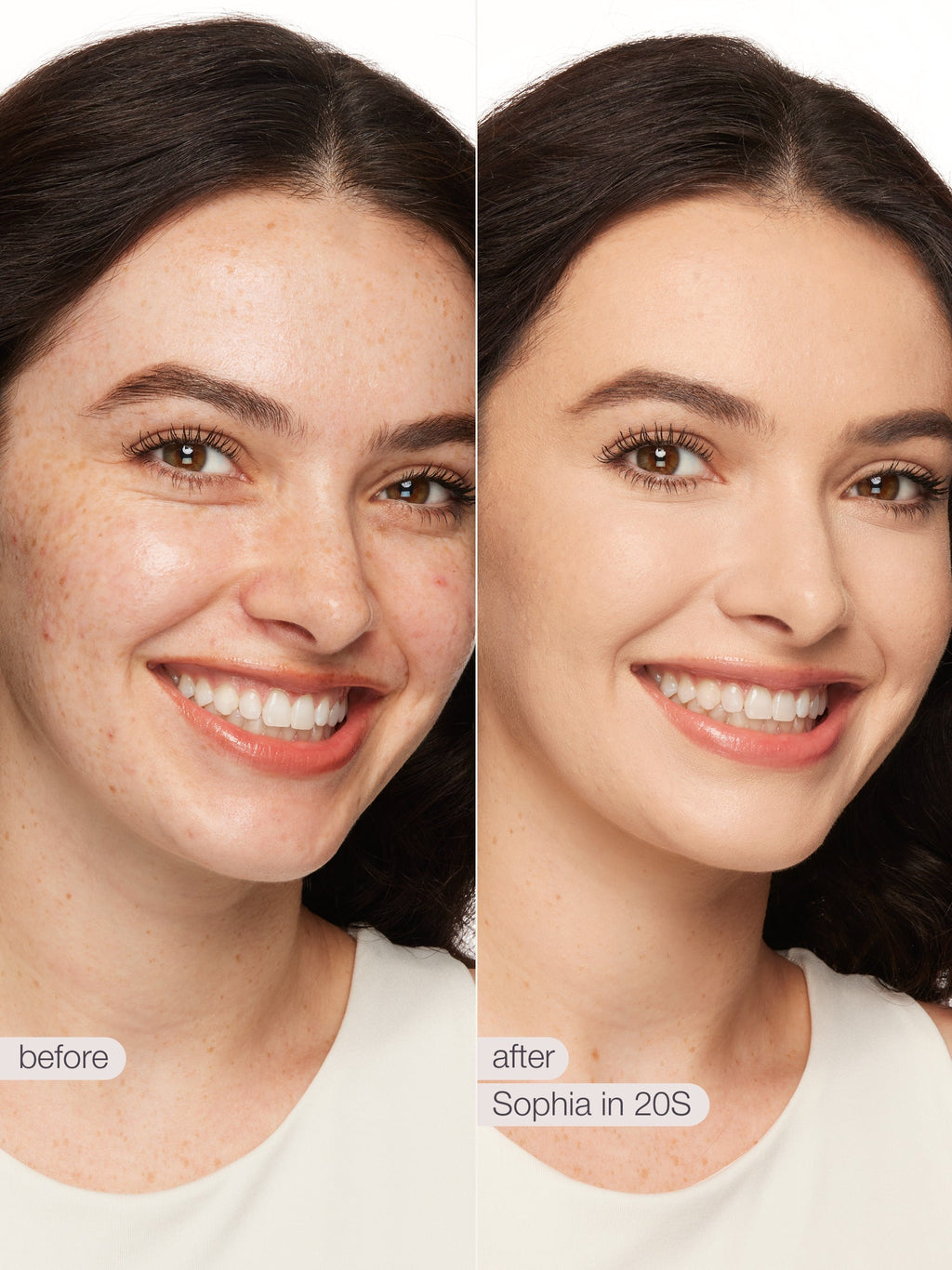 Before and after comparison of a woman's face with visible skin improvement using 'Sophia in 20S' product. using tarte shape tape concealer