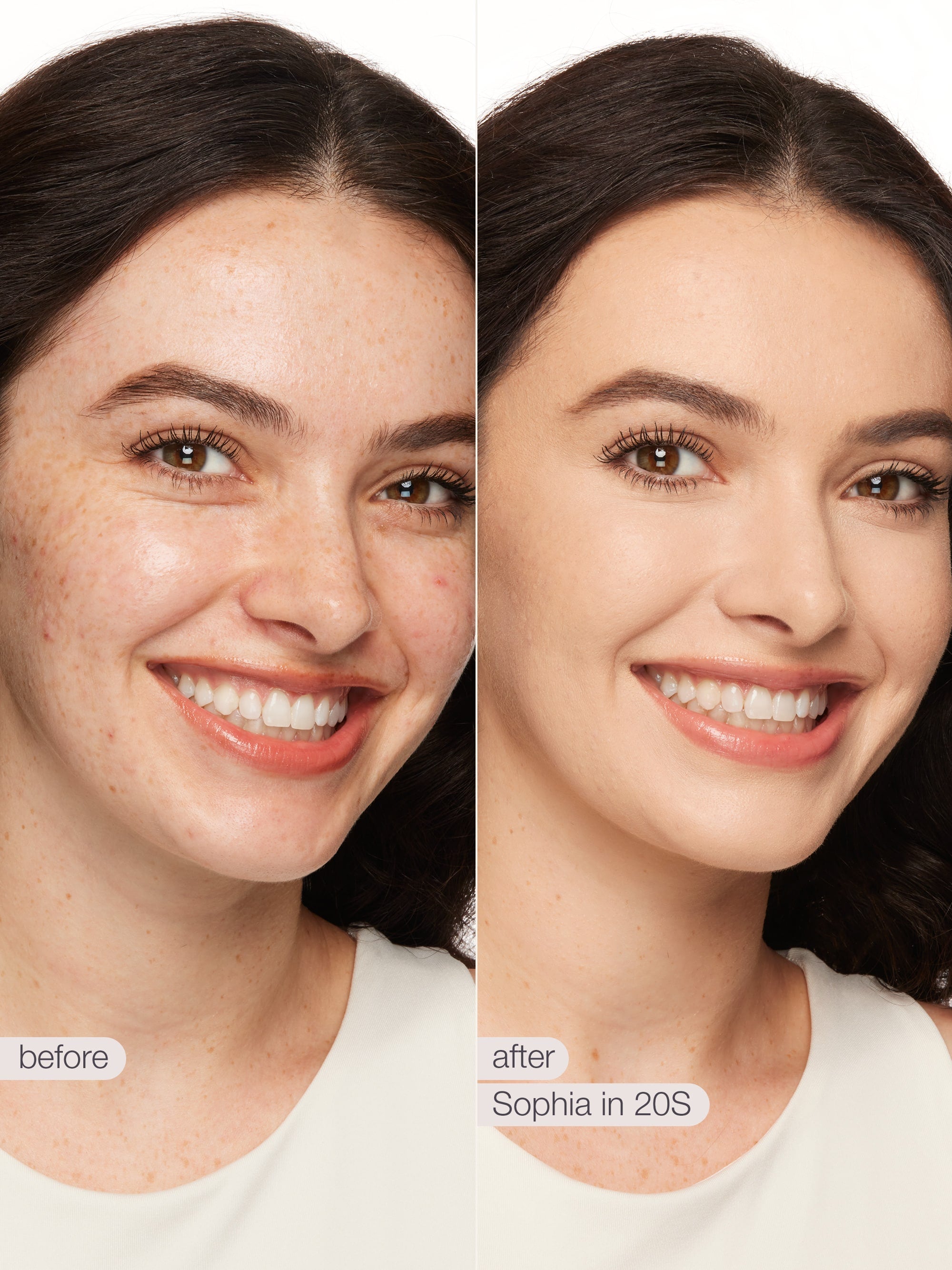 Before and after comparison of a woman's face with visible skin improvement using 'Sophia in 20S' product. using tarte shape tape concealer