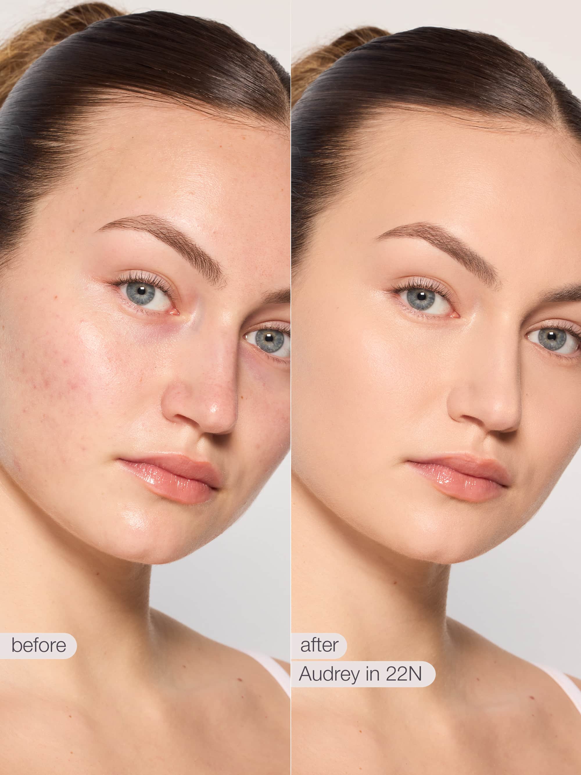 Before and after comparison of a woman's face with skin treatment product application. using tarte shape tape concealer