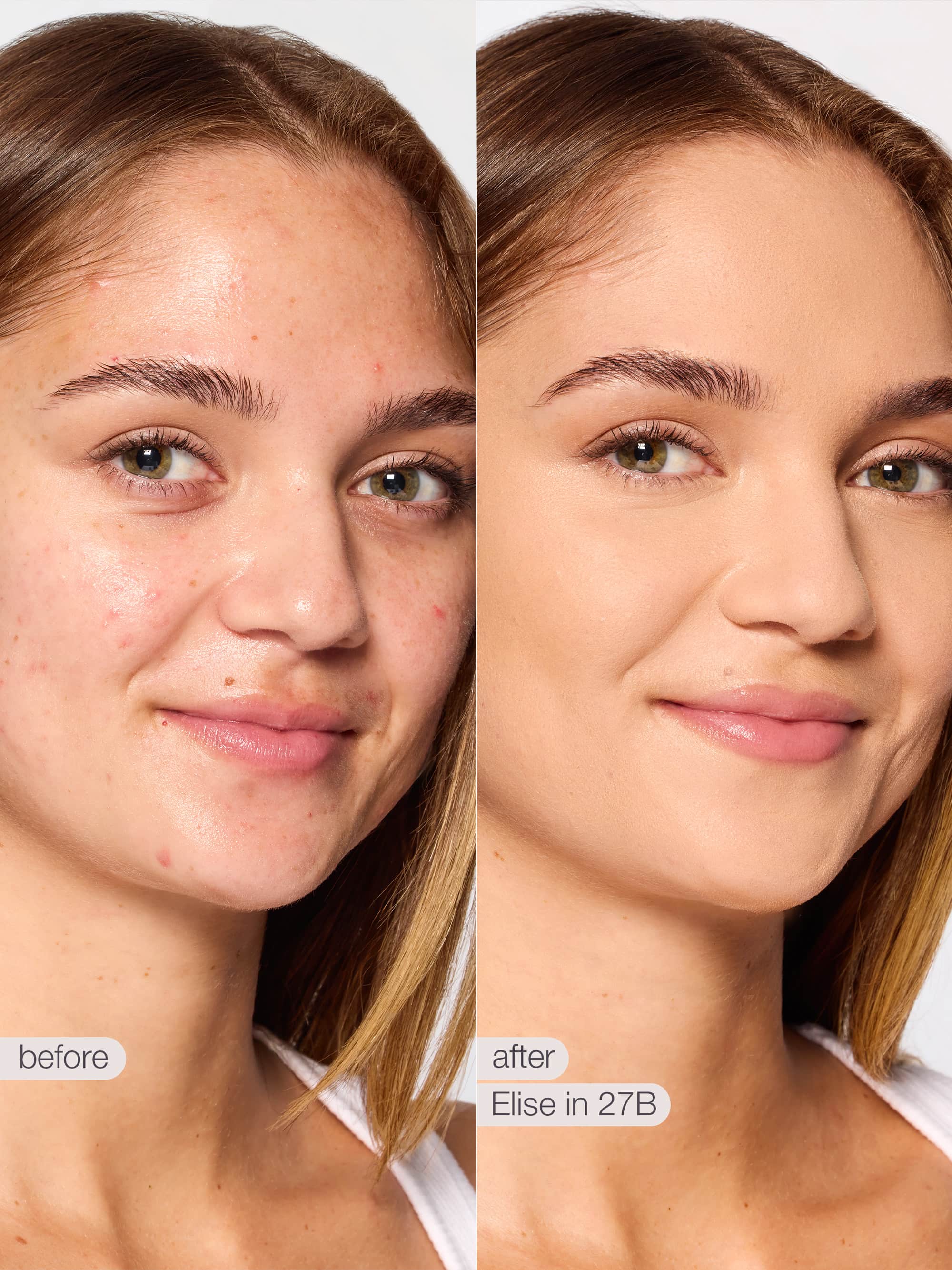 Before and after comparison of a woman's face with visible skin treatment results. using tarte shape tape concealer