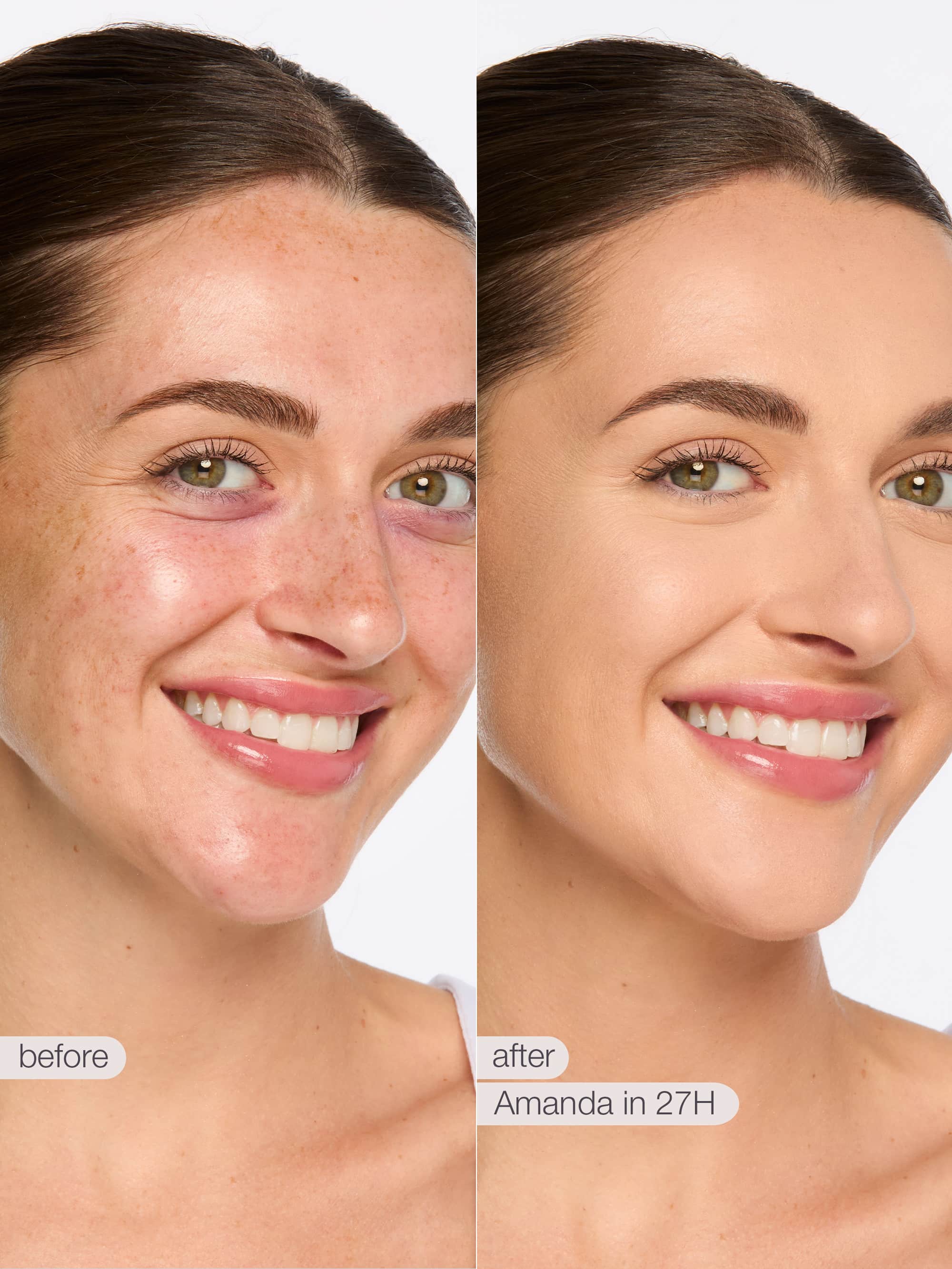 Before and after comparison of a woman's face with visible skin improvement. using tarte shape tape concealer