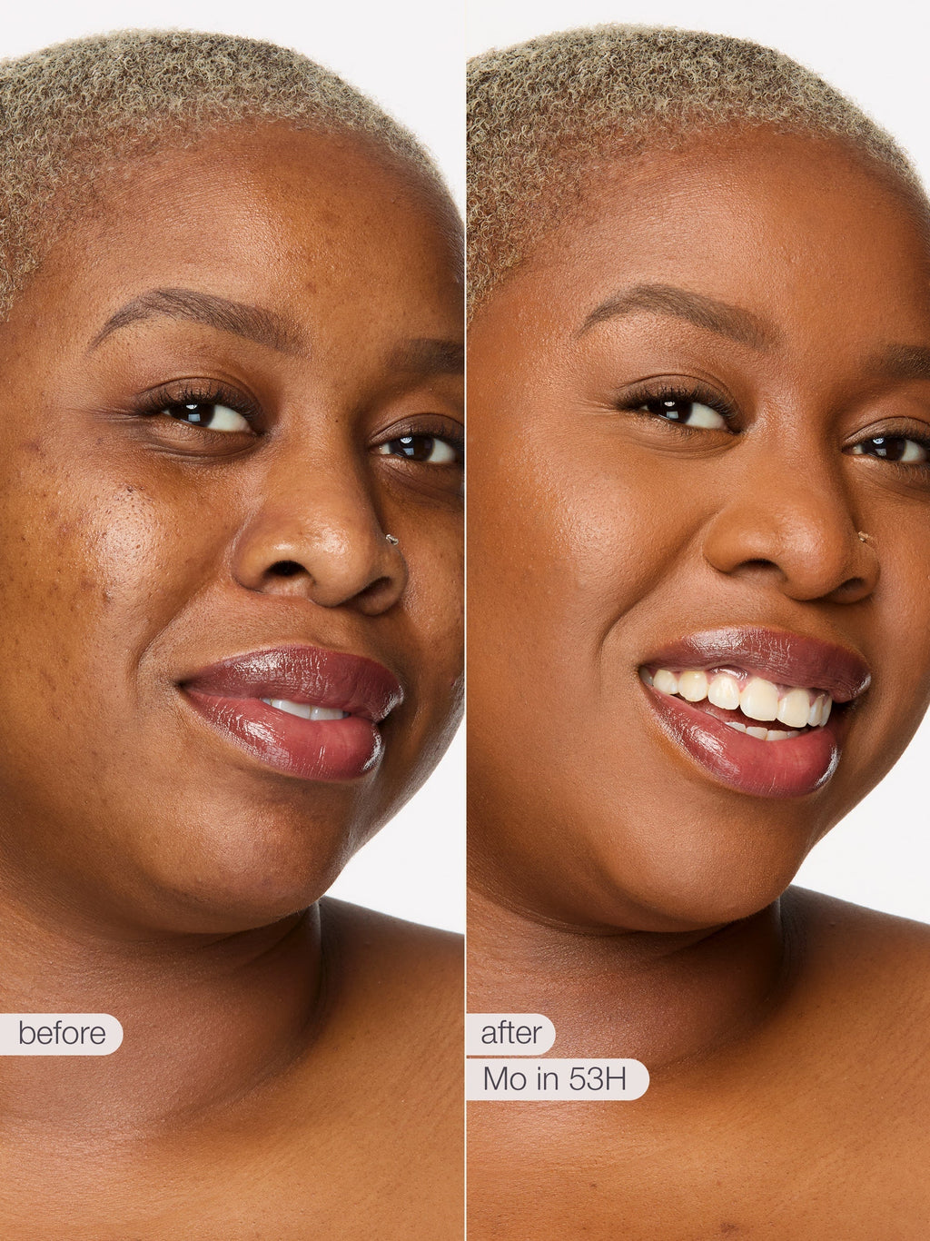 Before and after comparison of a woman's face with visible skin improvement. using tarte shape tape concealer