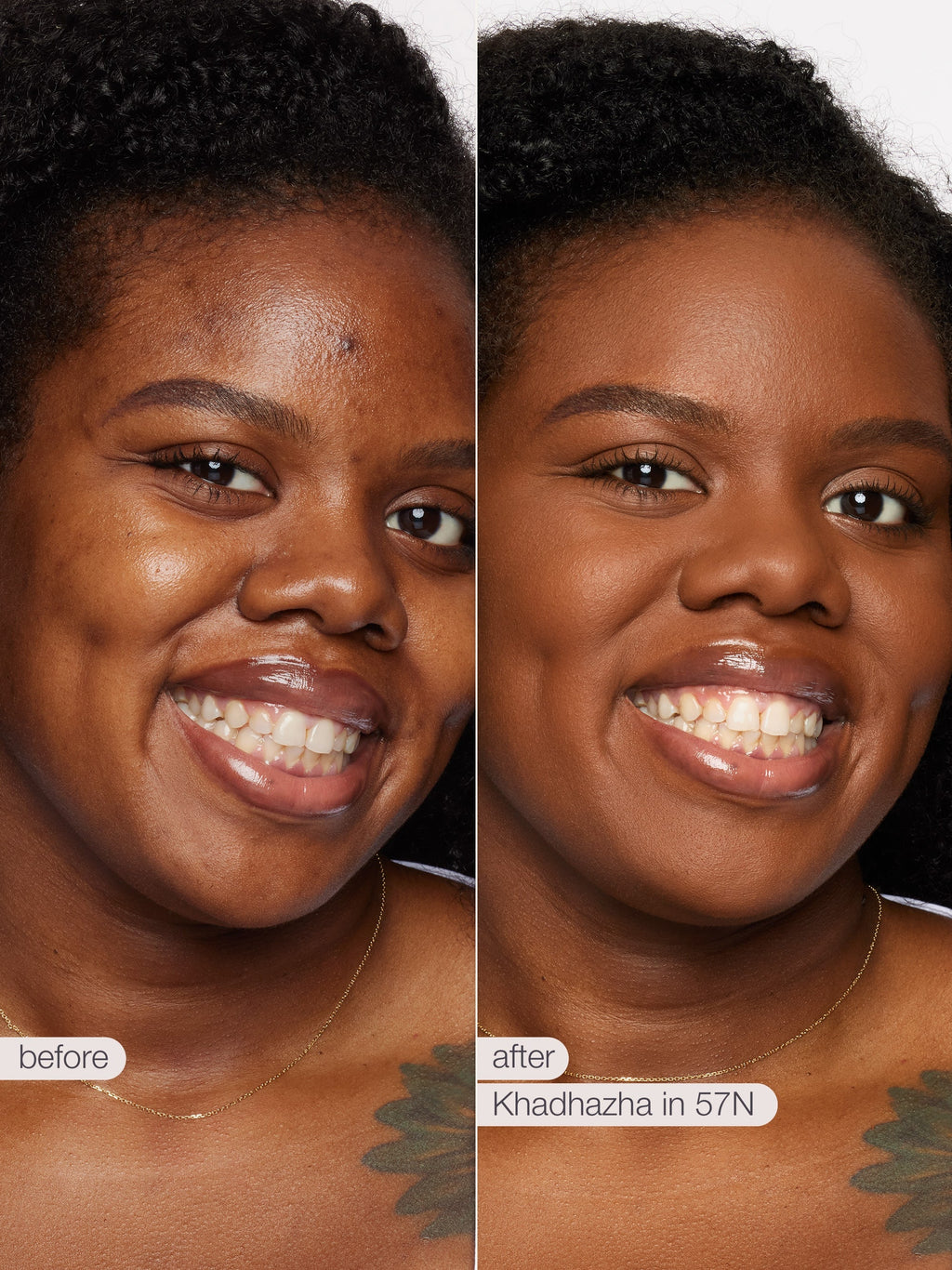 Before and after comparison of a woman's face with Knadzhazha in 57N treatment. using tarte shape tape concealer