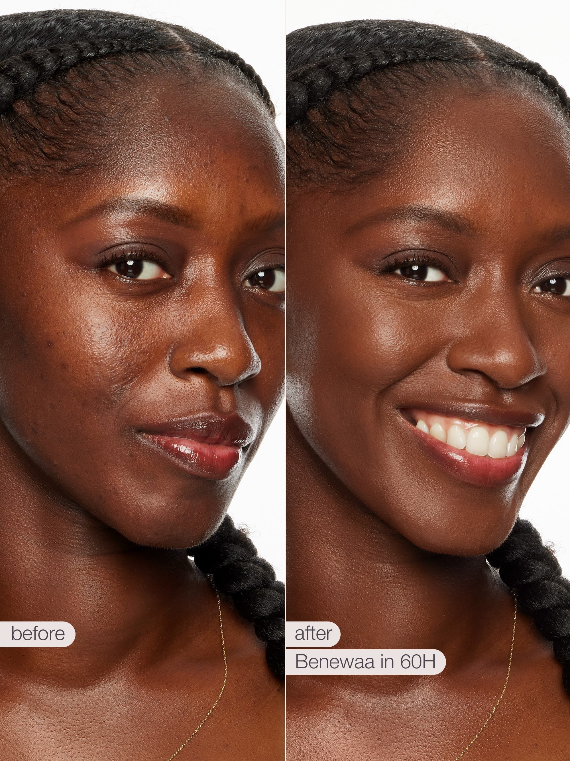 Before and after comparison of a woman's face with Benewaa skincare tarte shape tape concealer product.