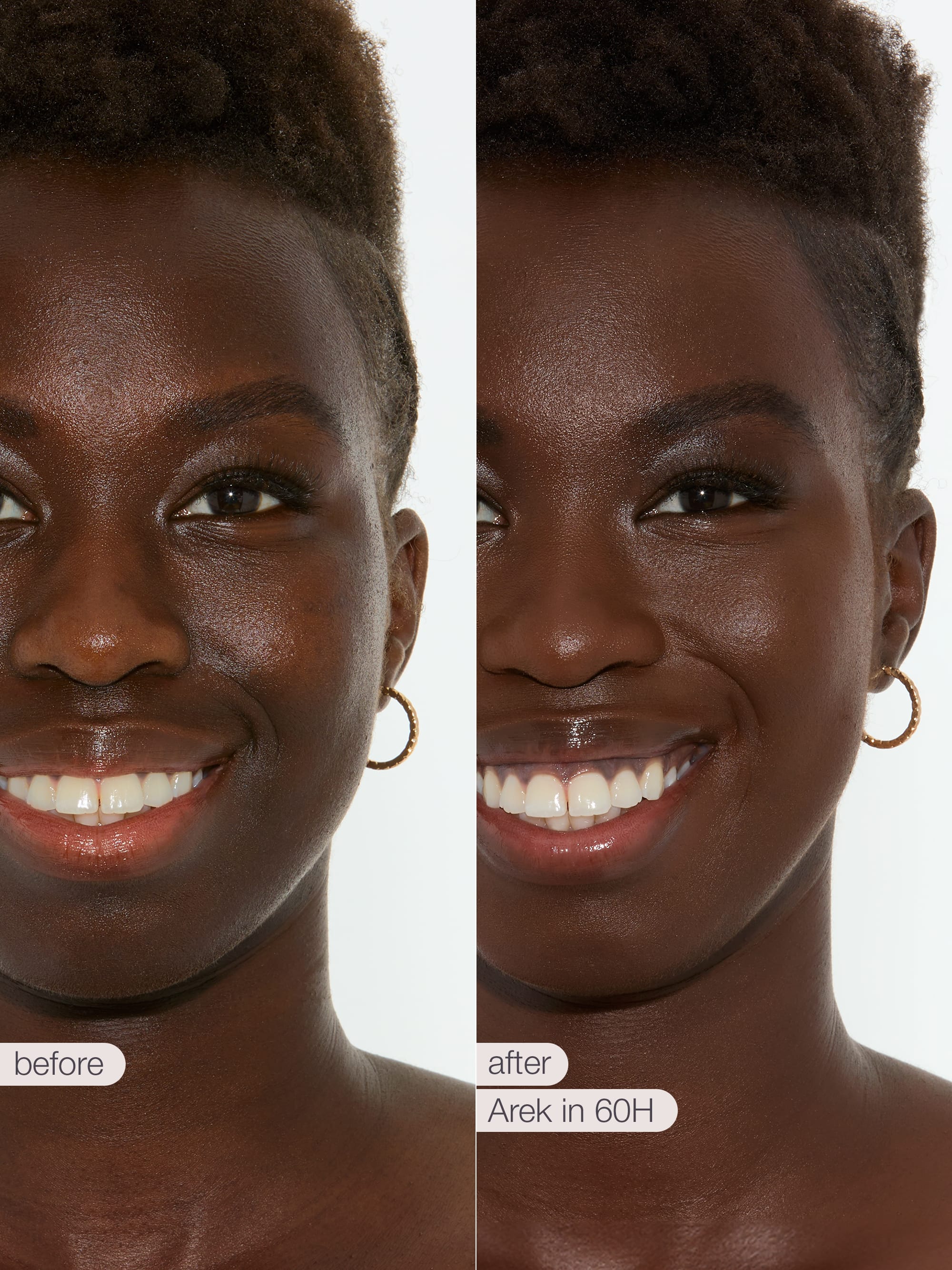 Before and after comparison of a woman's smile with text indicating 'before' and 'after' in tarte creaseless creamy concealer in shade 60H