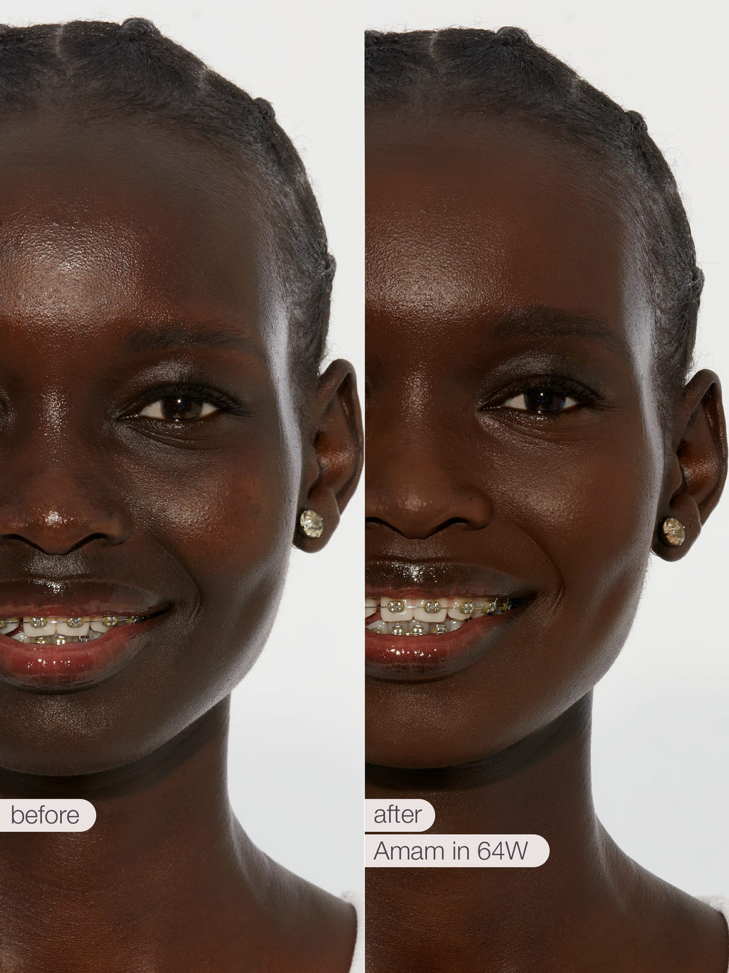 Before and after comparison of a woman's smile with dental braces, showing a close-up of her face.  tarte creaseless creamy concealer in shade 64W