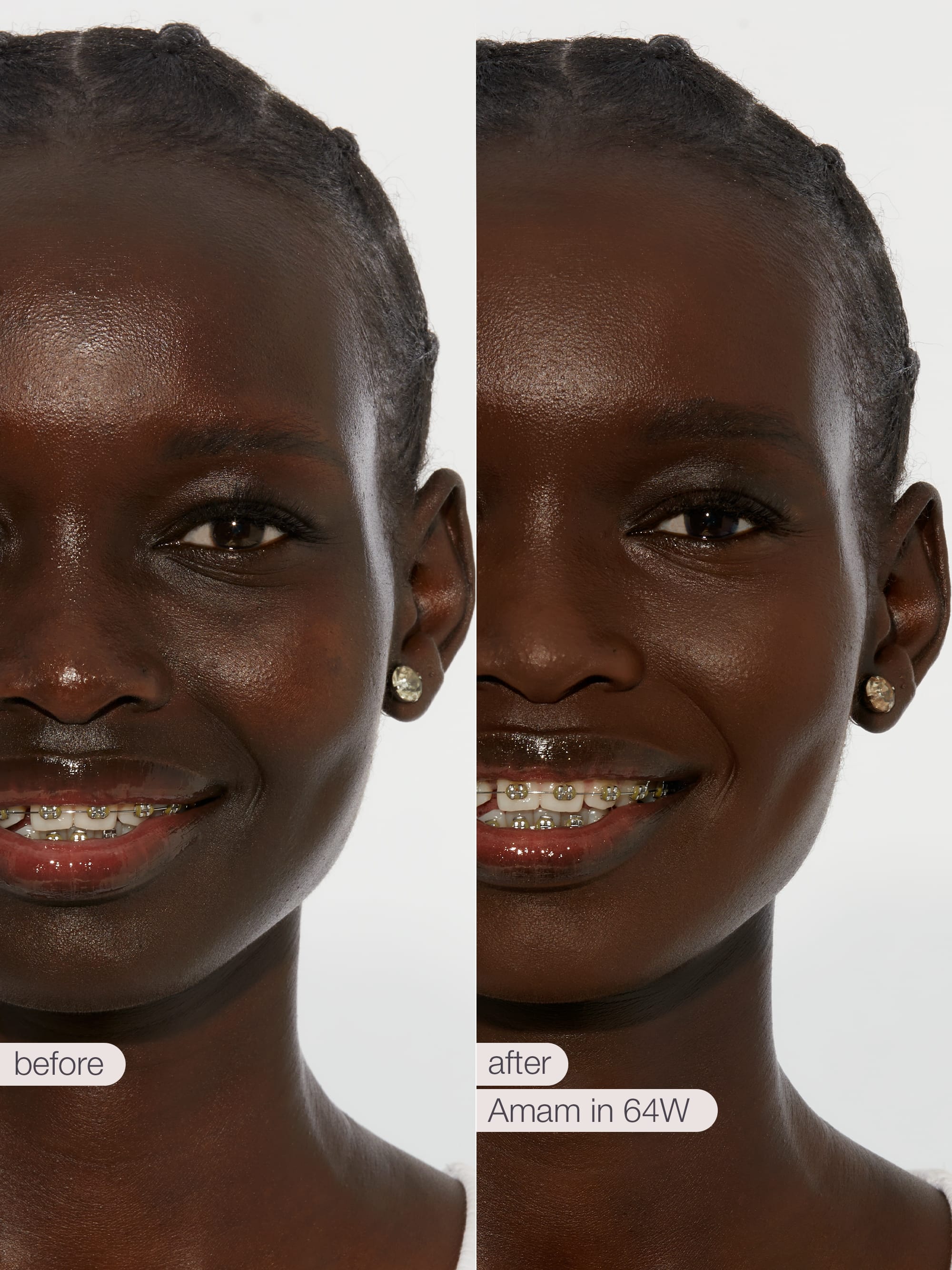 Before and after comparison of a woman's smile with dental braces, showing a close-up of her face.  tarte creaseless creamy concealer in shade 64W