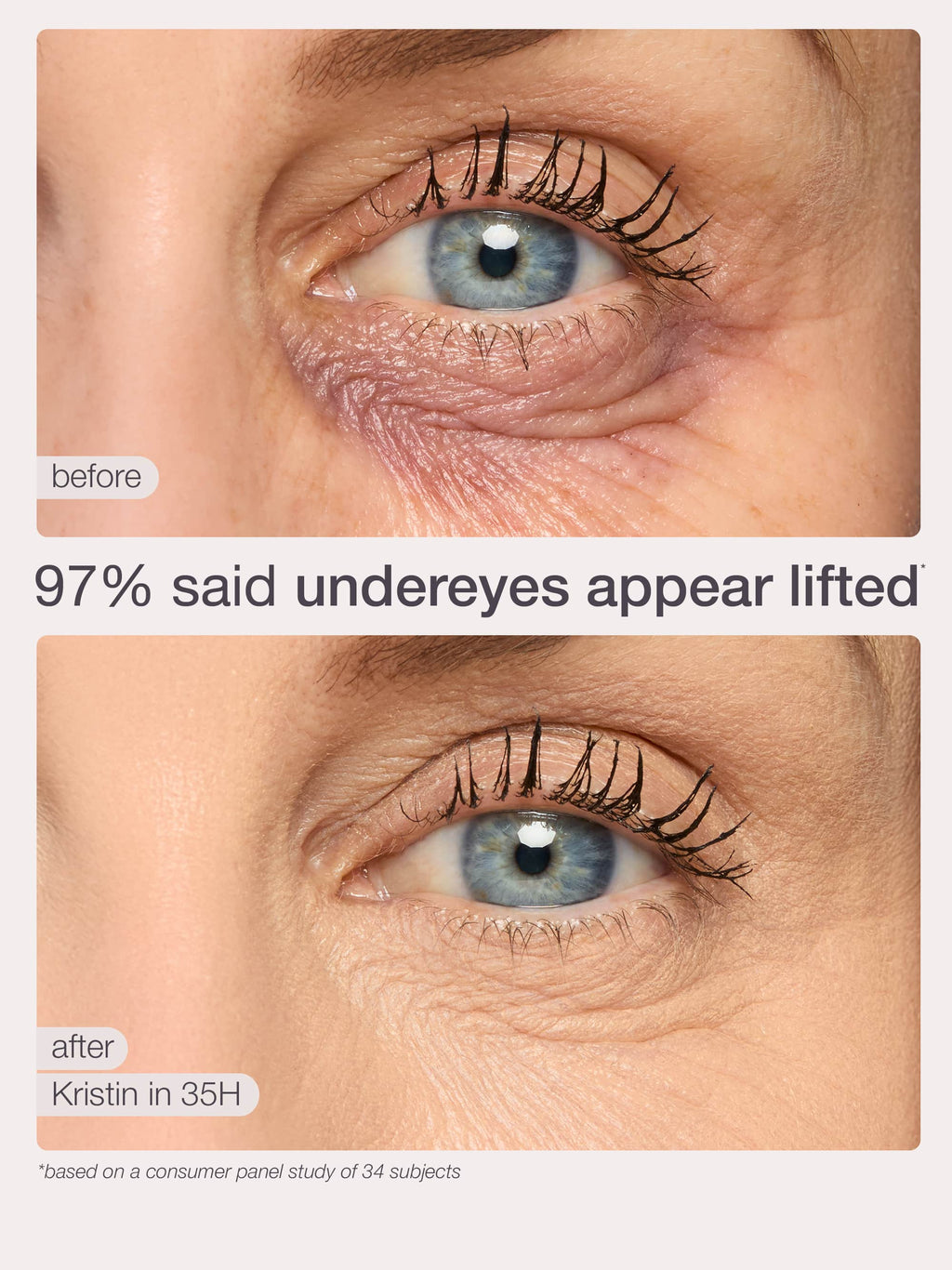 Two close-up images compare an eye before and after using Tarte Cosmetics. The before shows wrinkles, while the after shows smoother skin. Text: 97% said undereyes appear lifted.