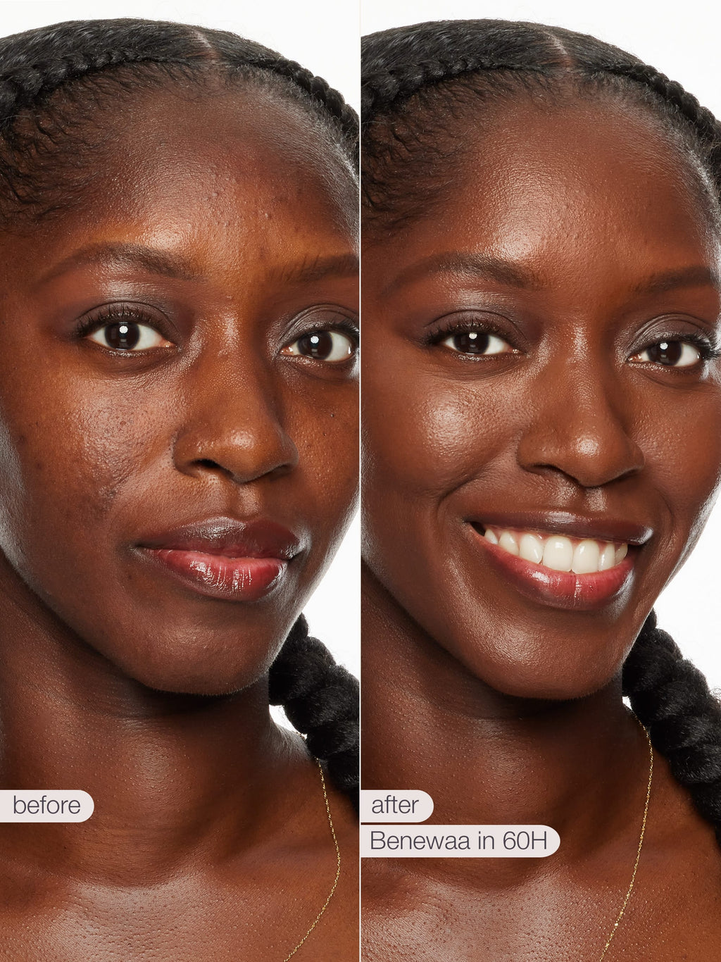 Before and after comparison of a woman's face with text indicating a product name and time frame.