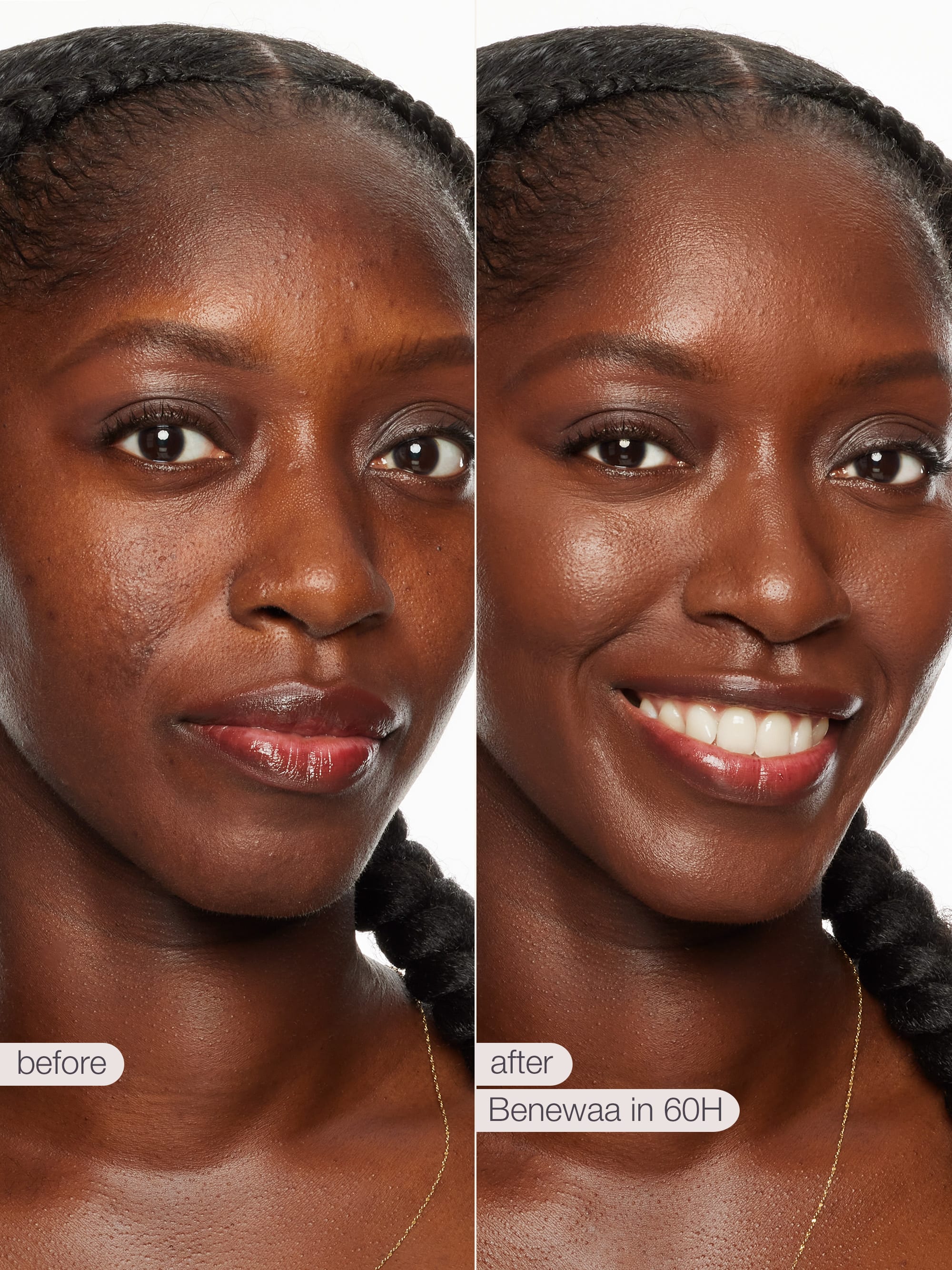 Before and after comparison of a woman's face with text indicating a product name and time frame.