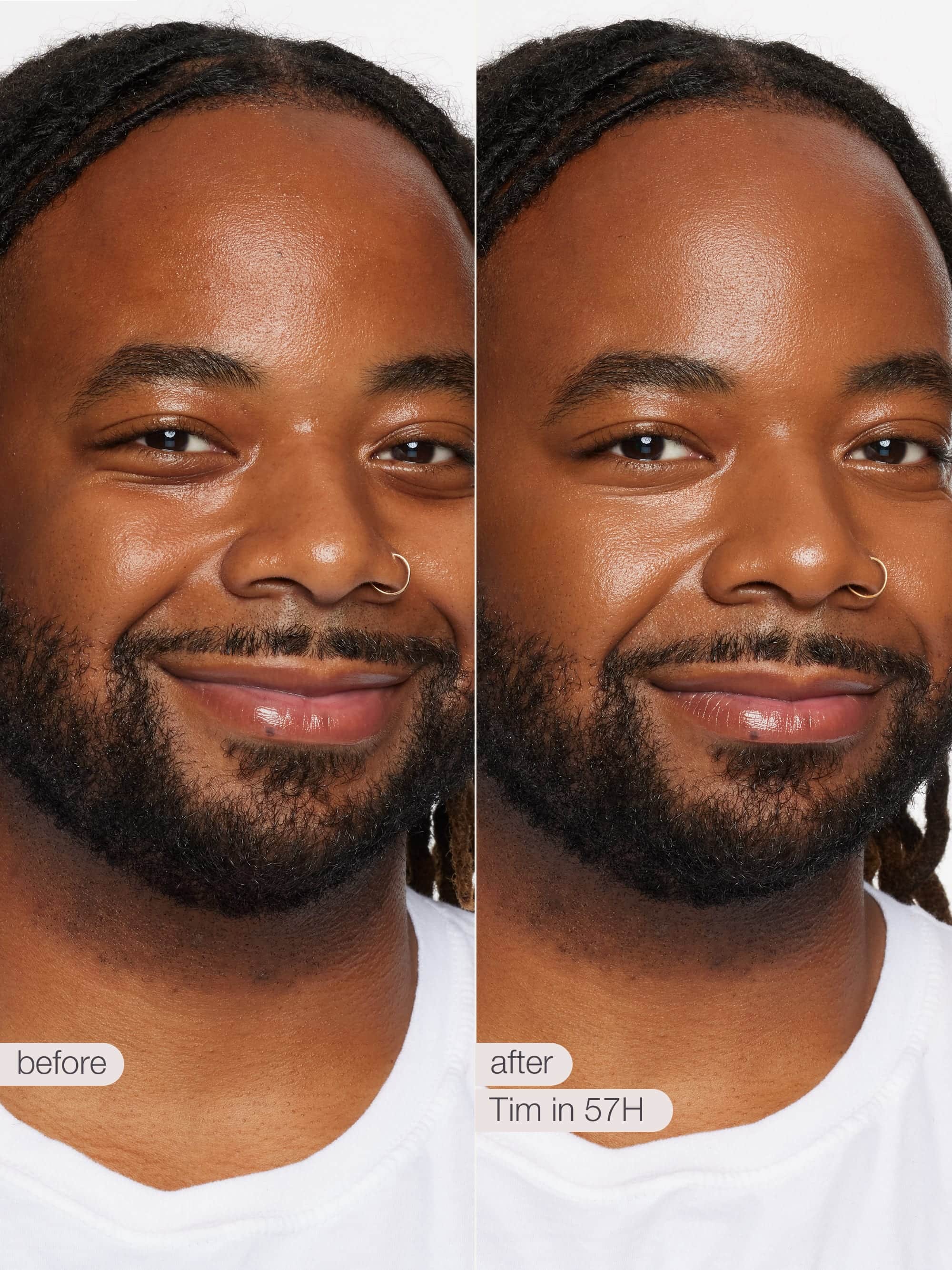 Before and after comparison of a man with facial hair and a white shirt.