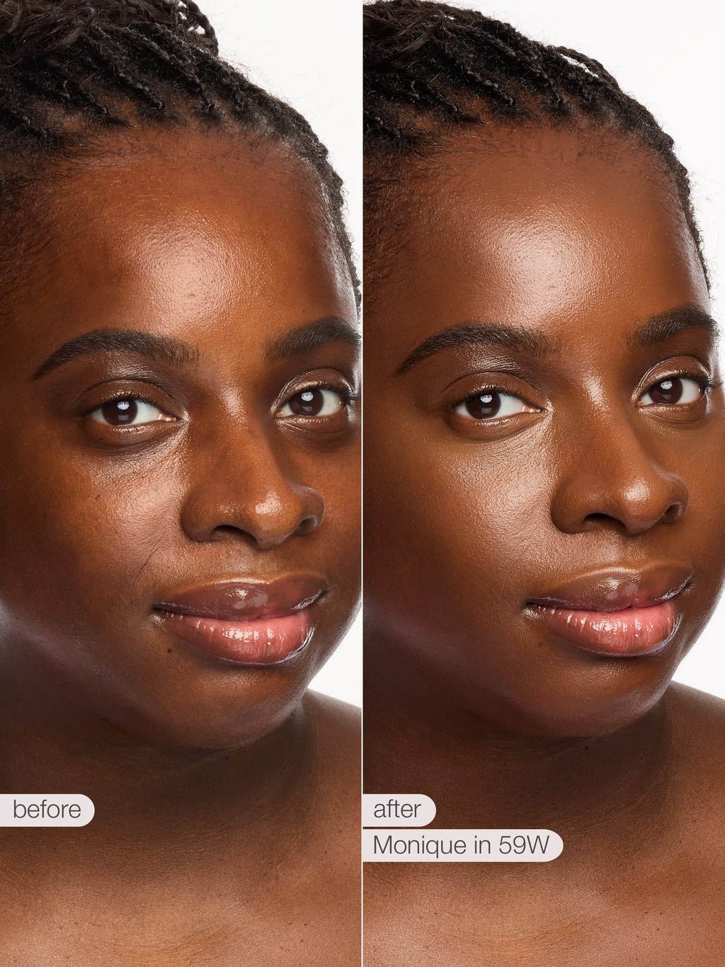 Before and after comparison of a woman's face with text indicating a product or treatment name.