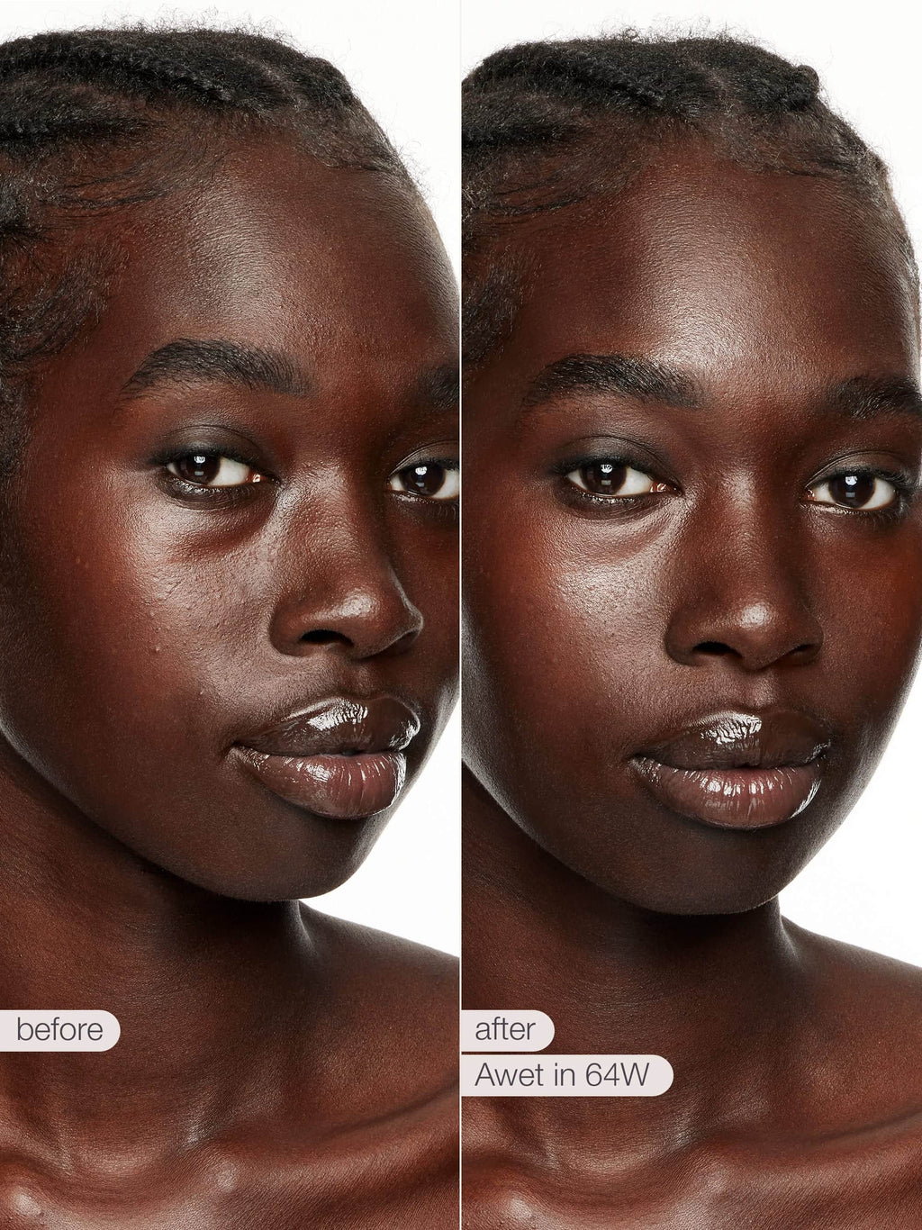 Before and after comparison of a woman's face with text indicating 'before' and 'after' on a white background.