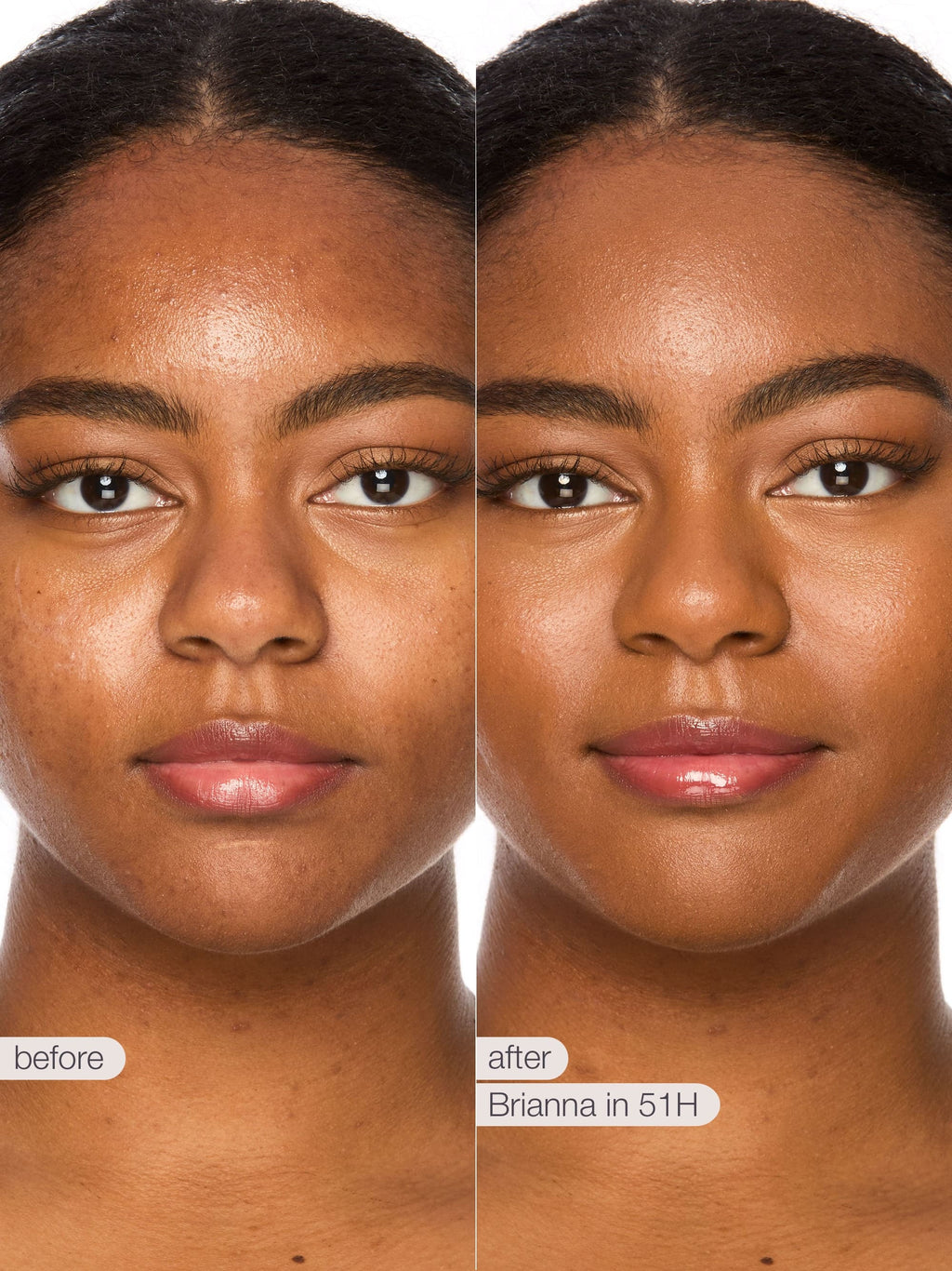 Before and after comparison of a woman's face with text indicating a skincare treatment.