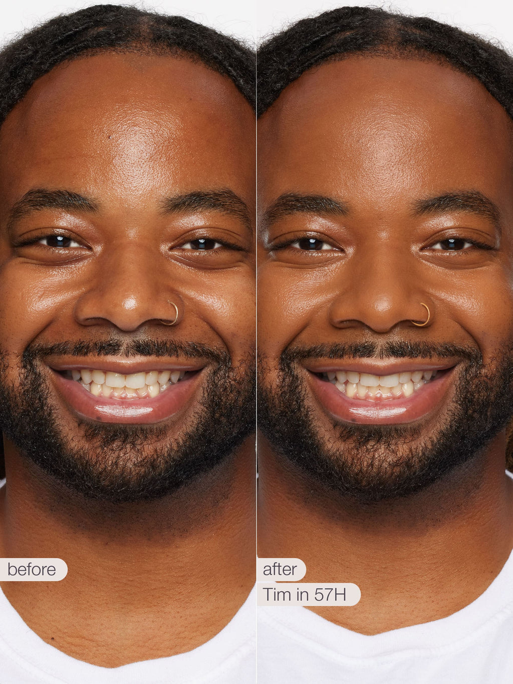 Before and after comparison of a man's face with a visible improvement in skin texture and brightness.