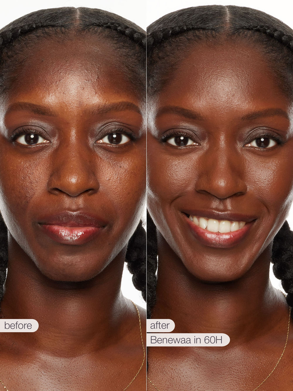 Before and after comparison of a woman's face with text indicating 'before' and 'after' and 'Benewaa in 60H'.