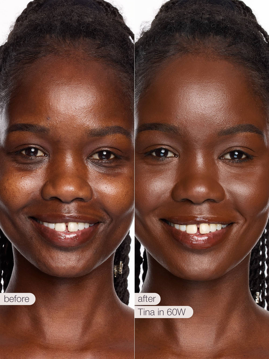 Before and after comparison of a woman's skin with a product labeled 'Tina in 60W'.
