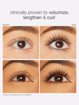 Before and after comparison of eyelashes with text indicating clinical provenance.