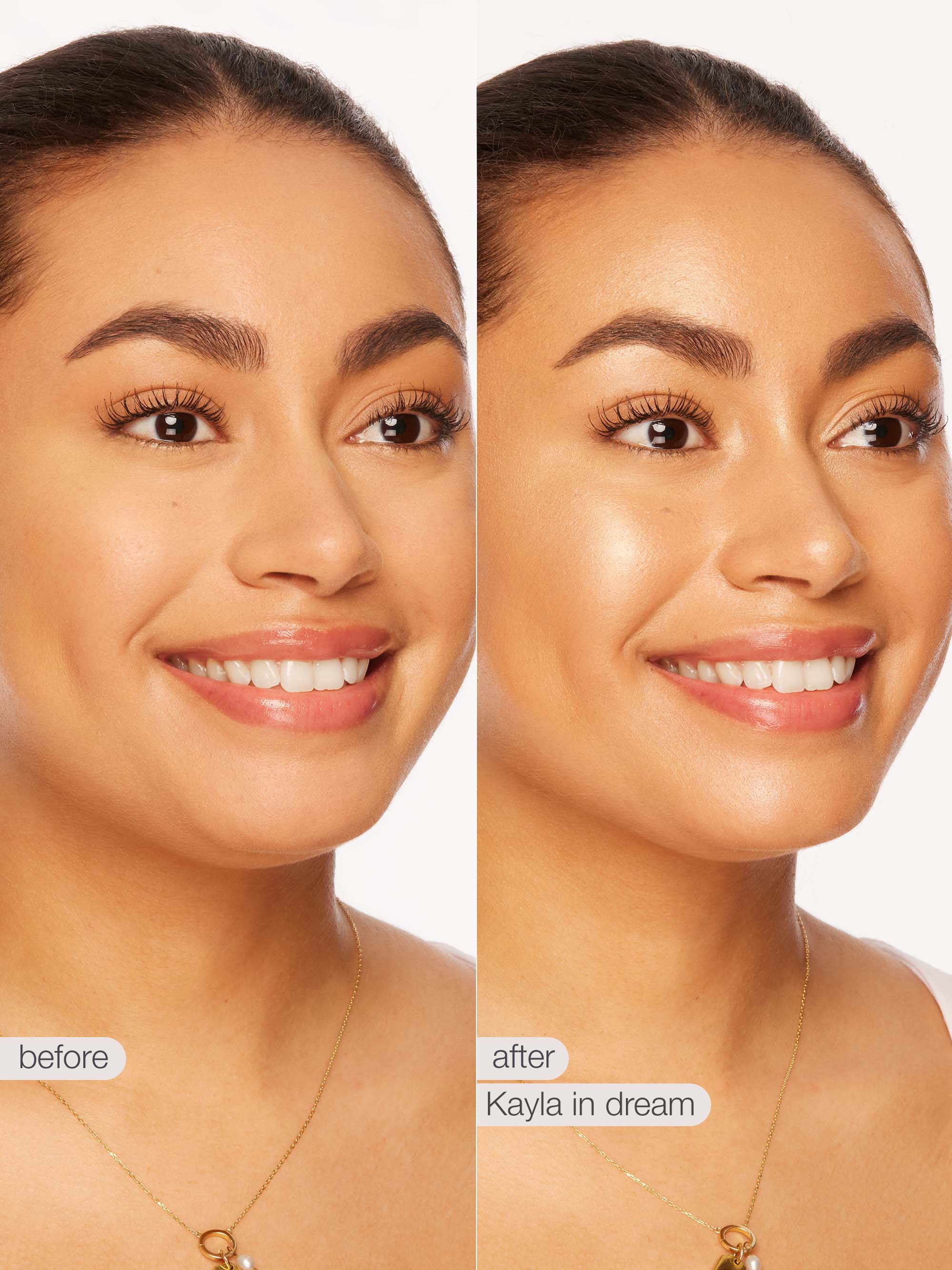 Before and after comparison of a woman's face with 'before' and 'after' labels.