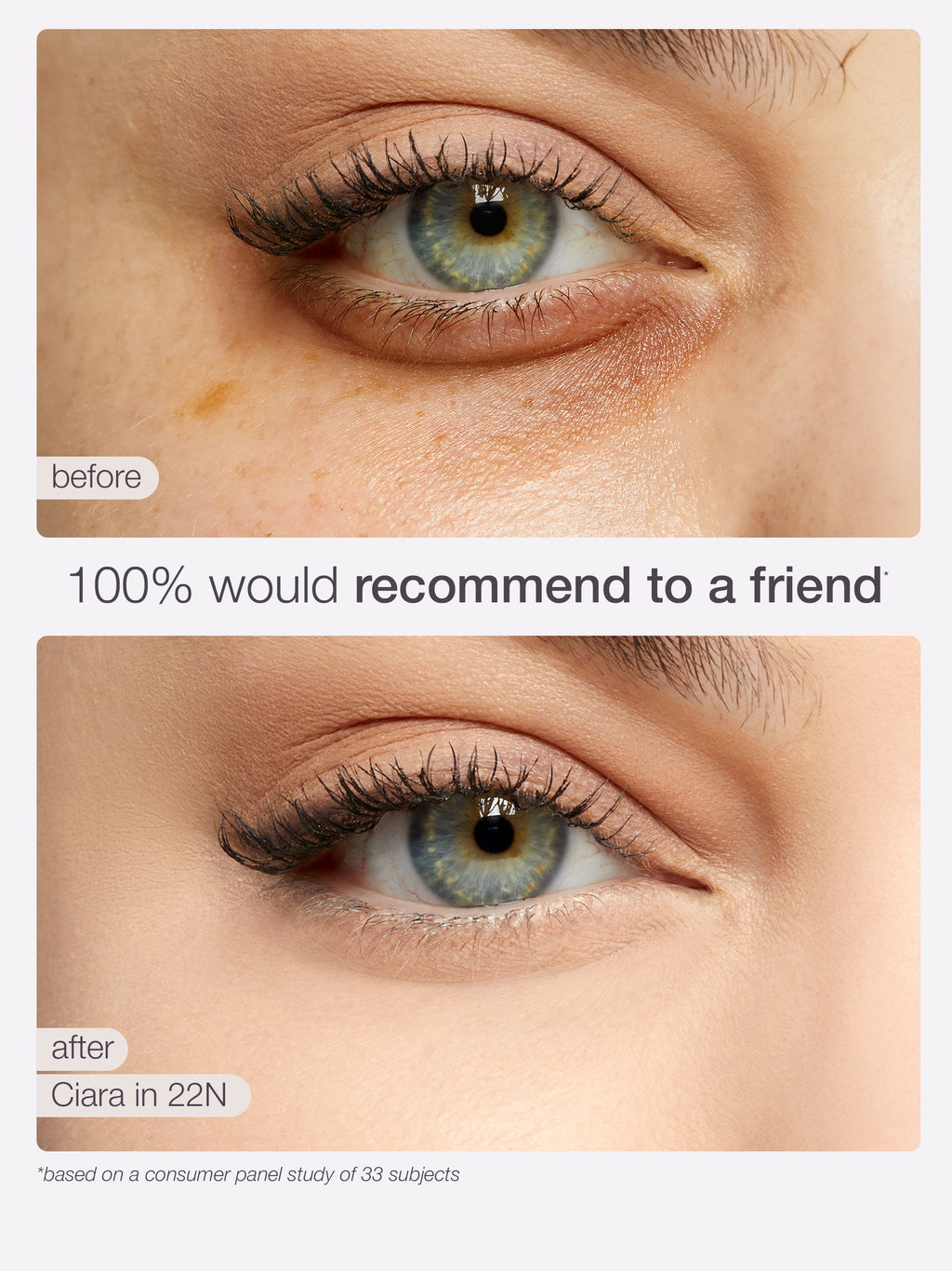 Before and after comparison of a eye treatment showing a reduction in a blemish.