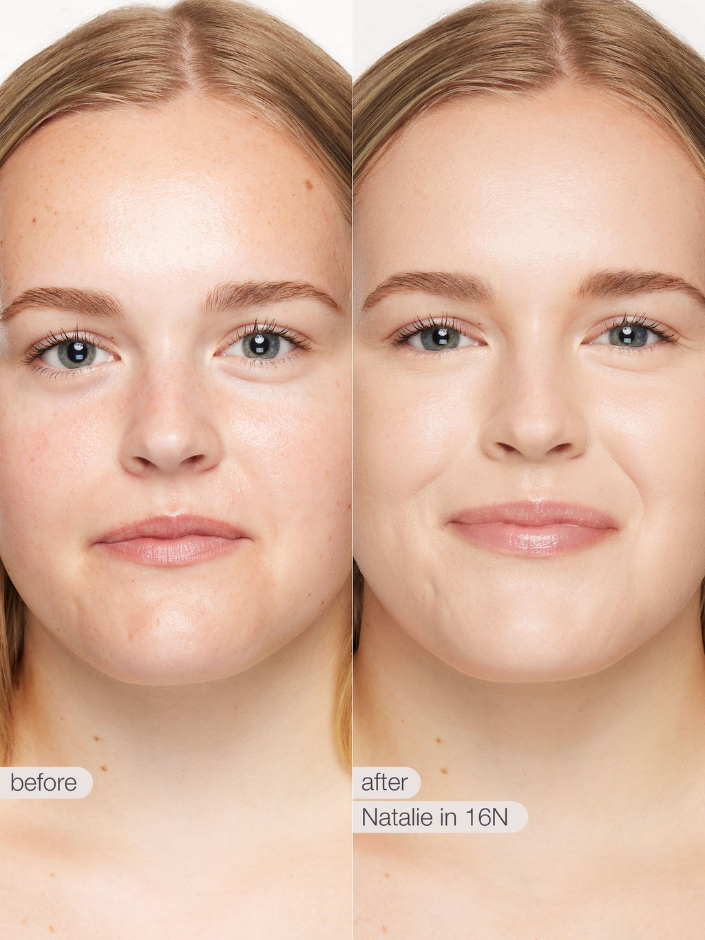 Before and after comparison of a woman's face with visible skin improvement.