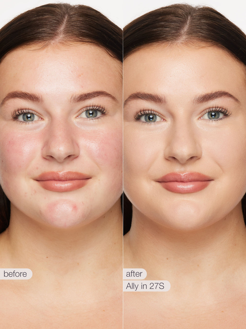 Before and after comparison of a woman's face with text indicating a skincare treatment.