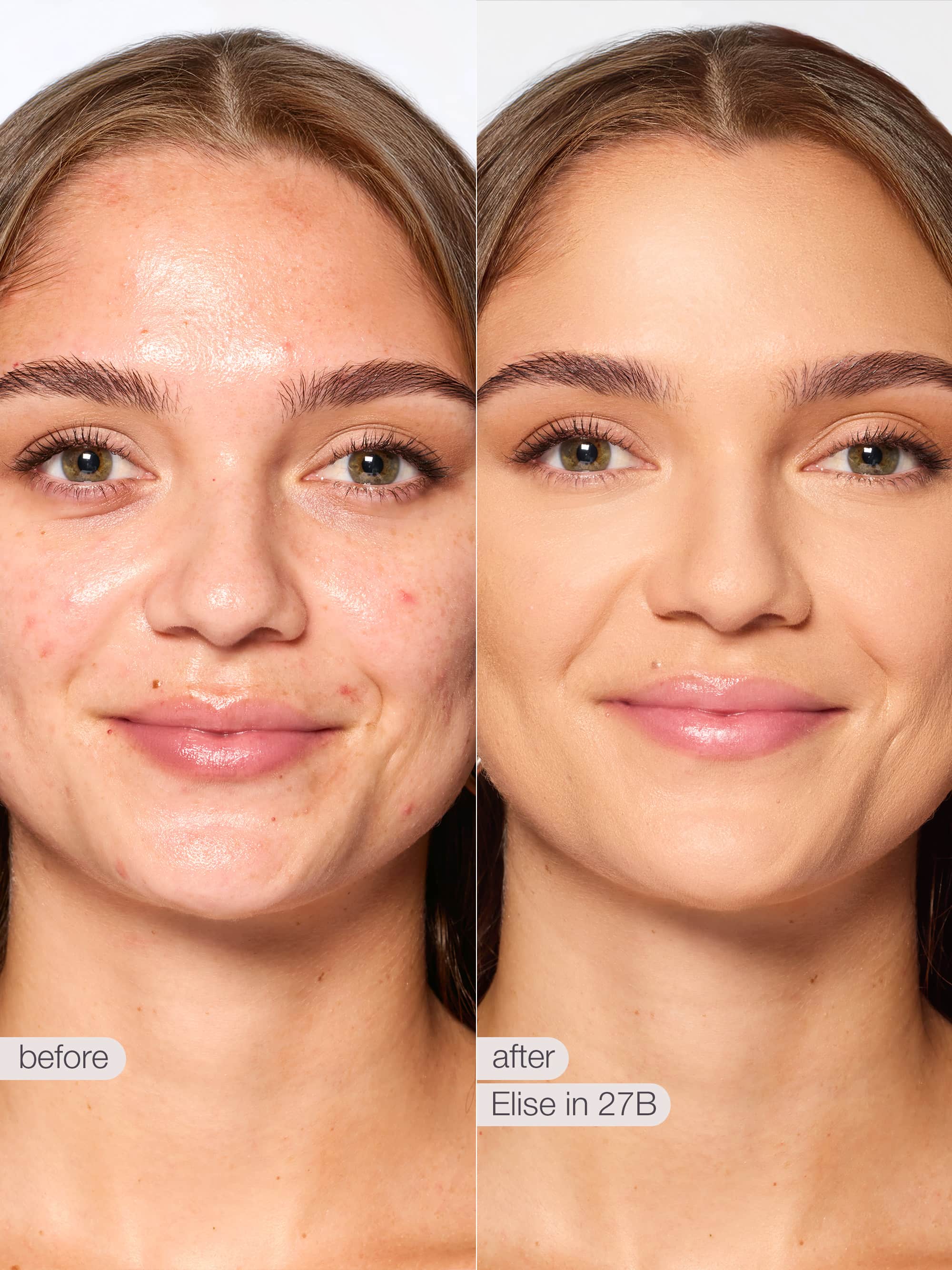 Before and after comparison of a woman's face with text 'before' and 'after Sophia in 278'.