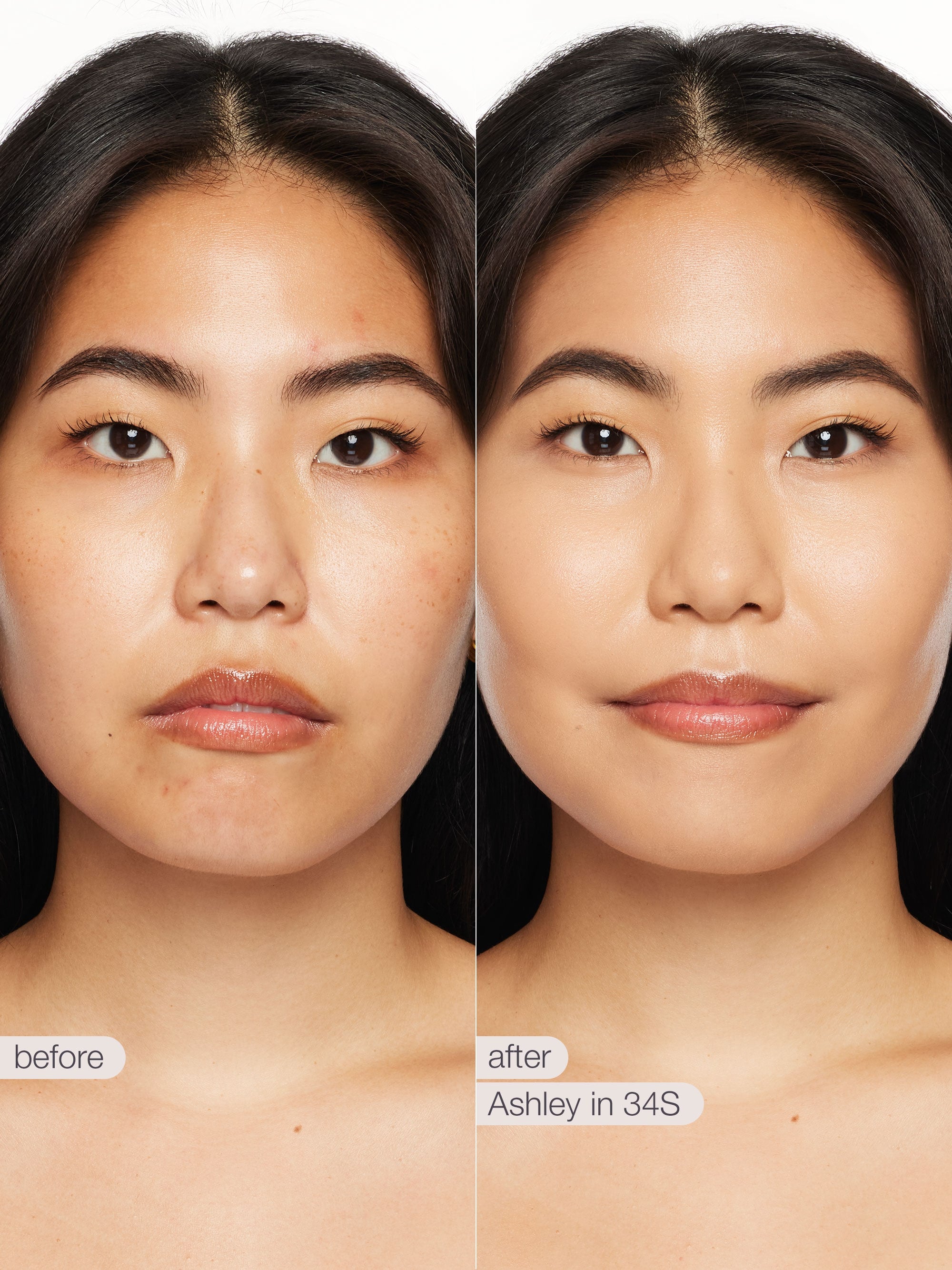 Before and after comparison of a woman's face with text indicating 'before' and 'after' on a white background.