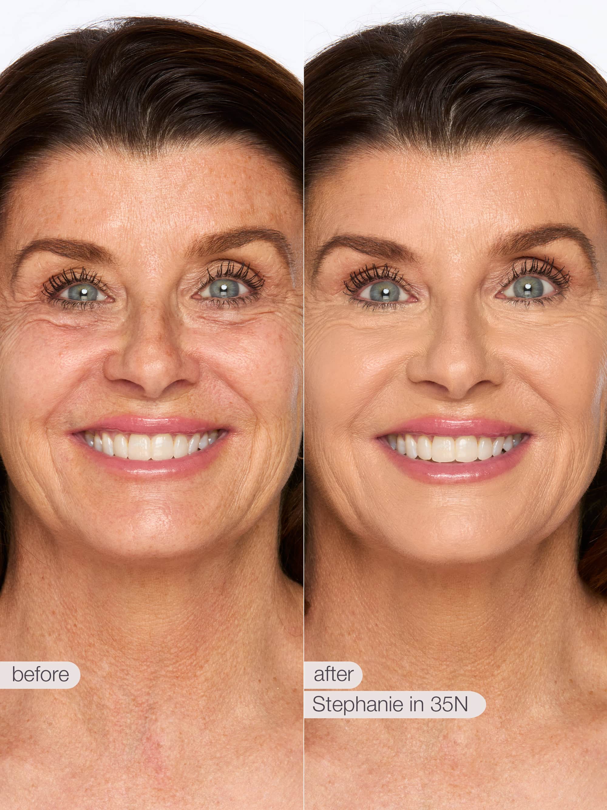 Before and after comparison of a woman's face with text indicating 'before' and 'after' and a name.