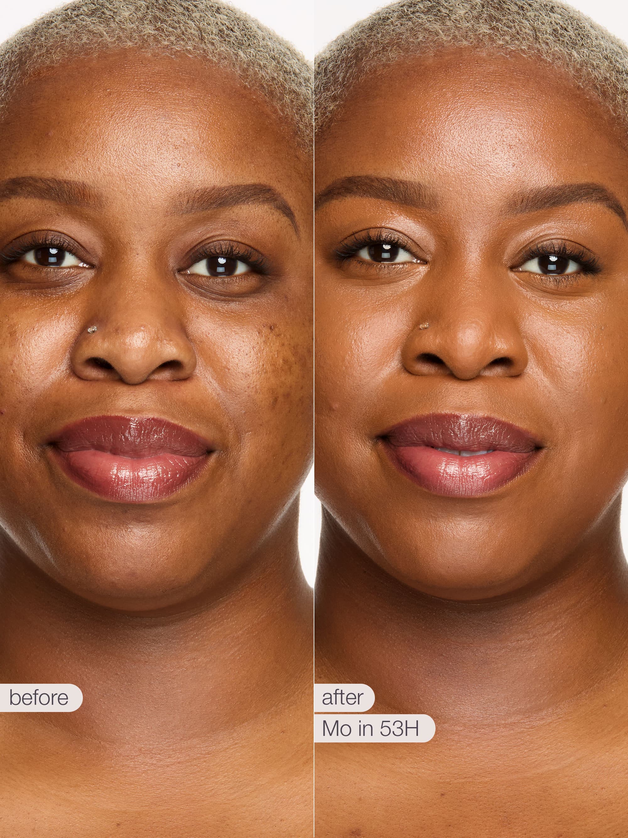 Before and after comparison of a woman's face with text indicating 'before' and 'after' on a white background.