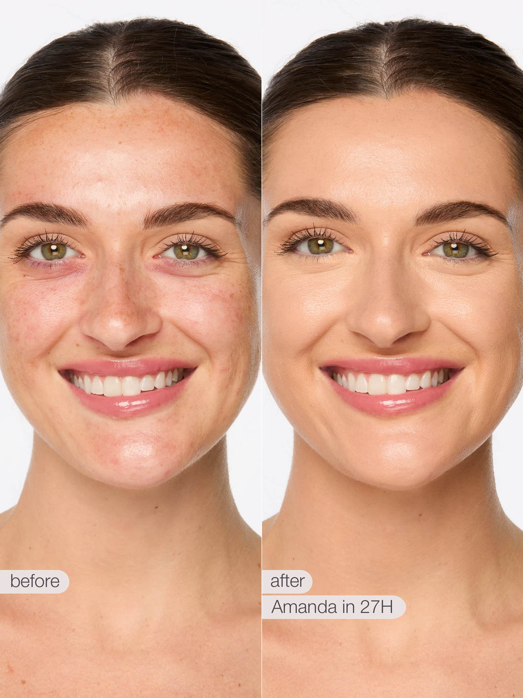 Before and after comparison of a woman's face with text indicating a product application time.