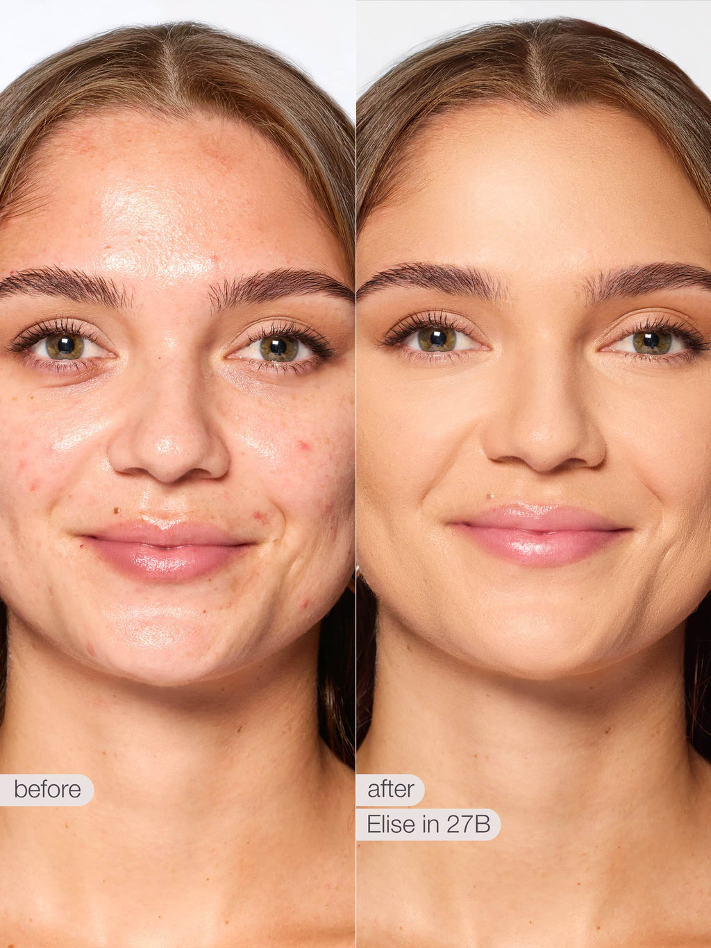 Before and after comparison of a woman's face with text 'before' and 'after Sophia in 278'.