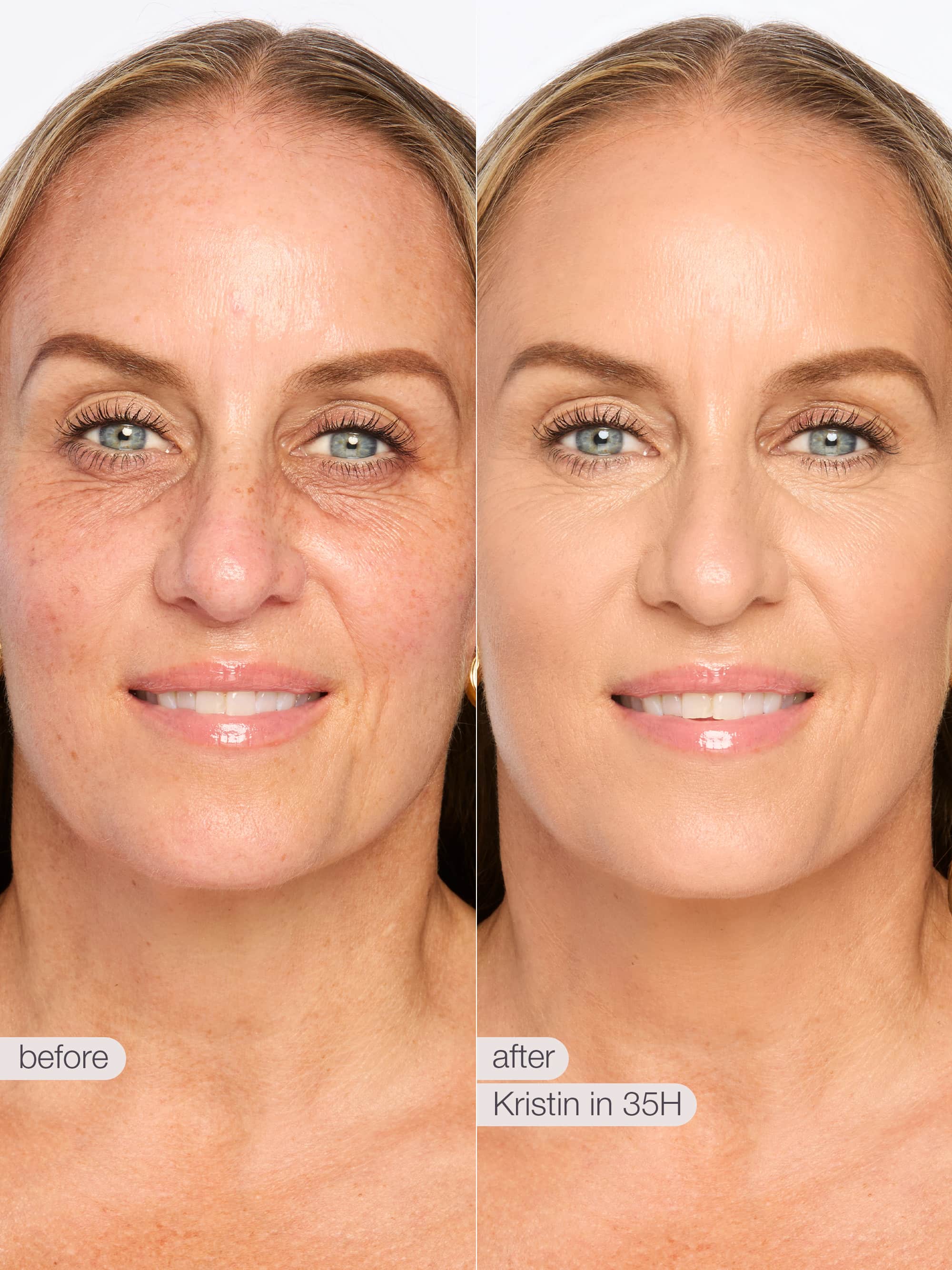 Before and after comparison of a woman's face with text indicating 'before' and 'after' and product name.