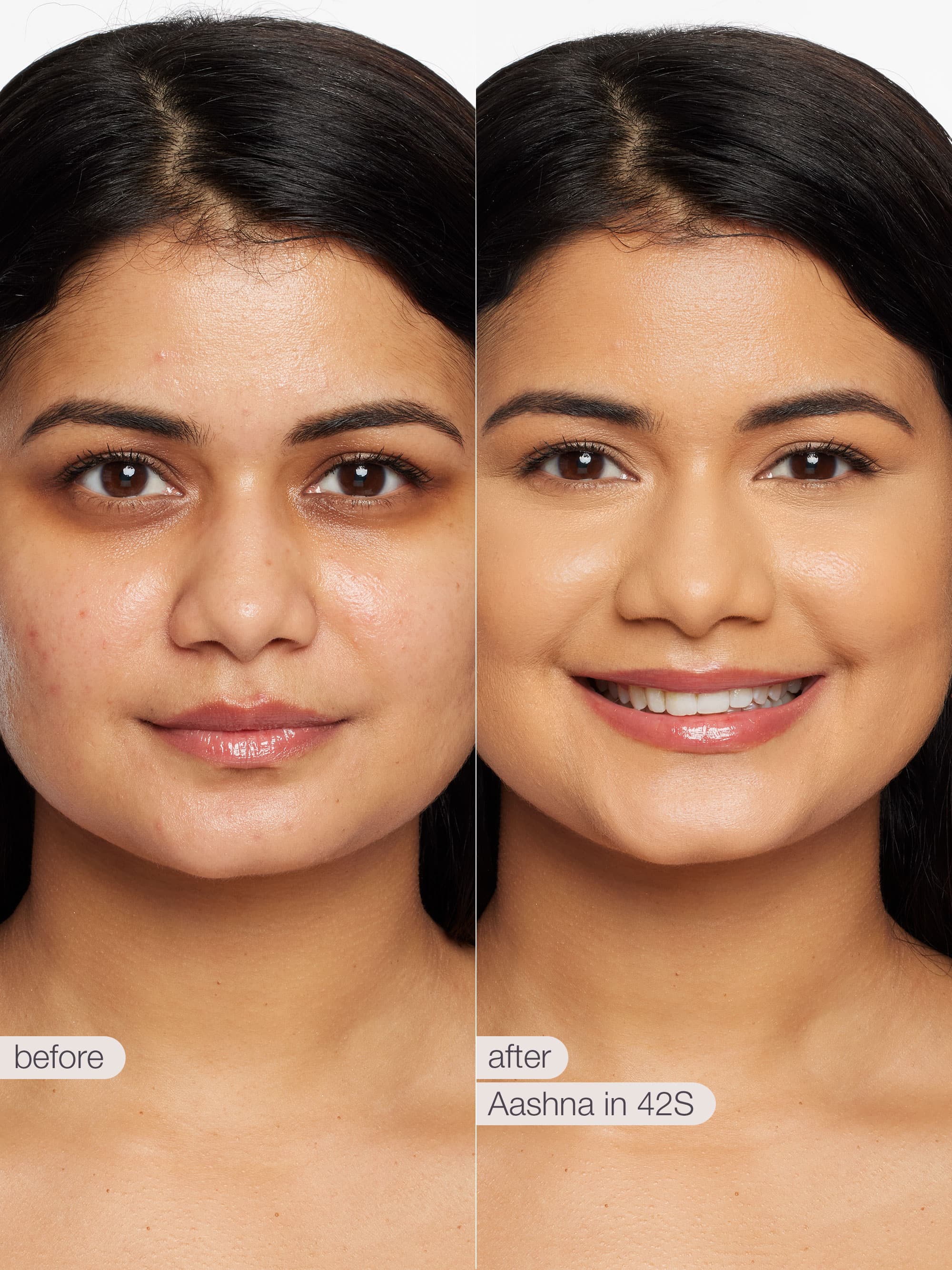 Before and after comparison of a woman's face with 'Aashna in 42S' treatment.