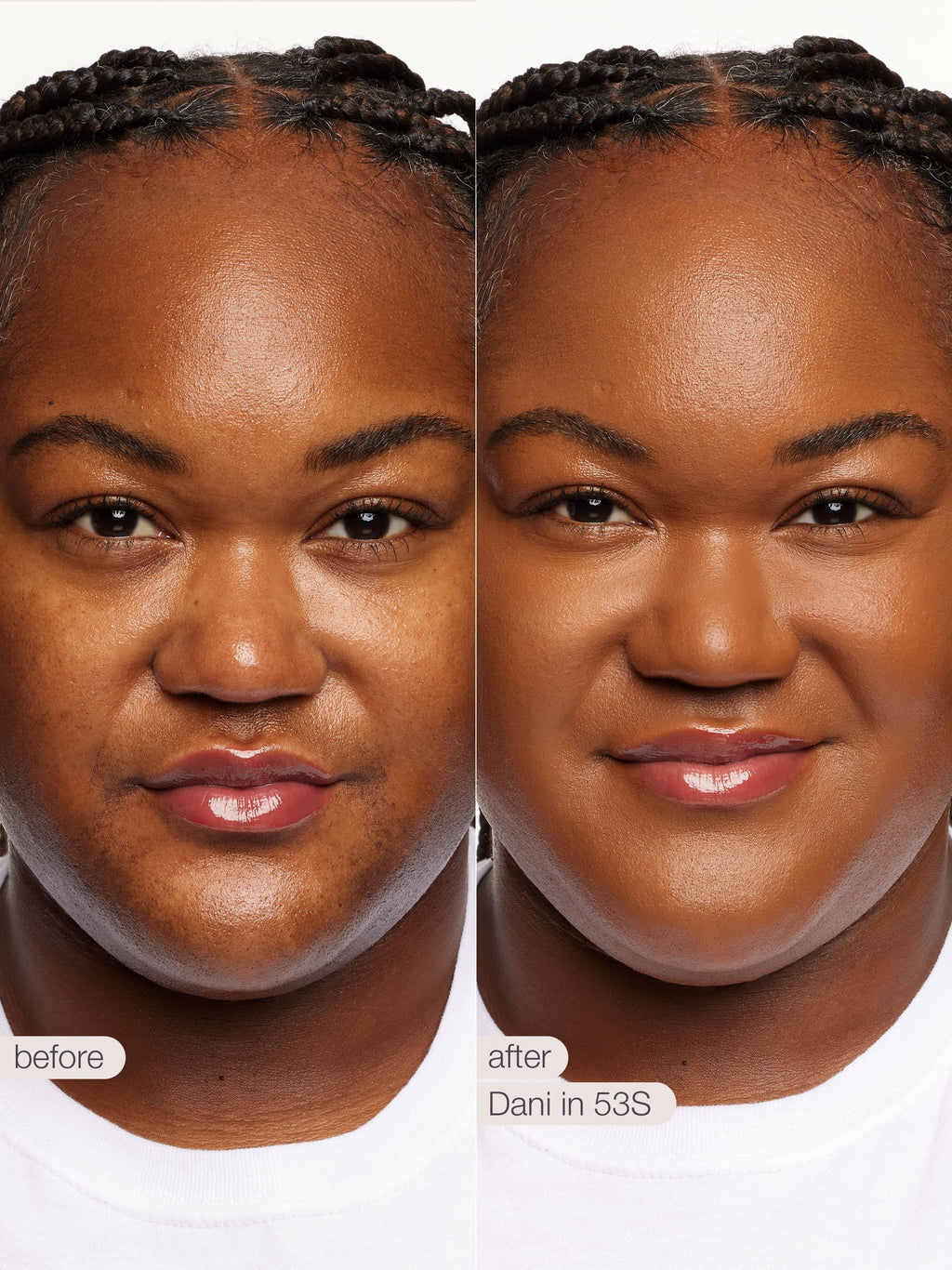 Before and after comparison of a woman's face with text indicating 'before' and 'after' on a white background.