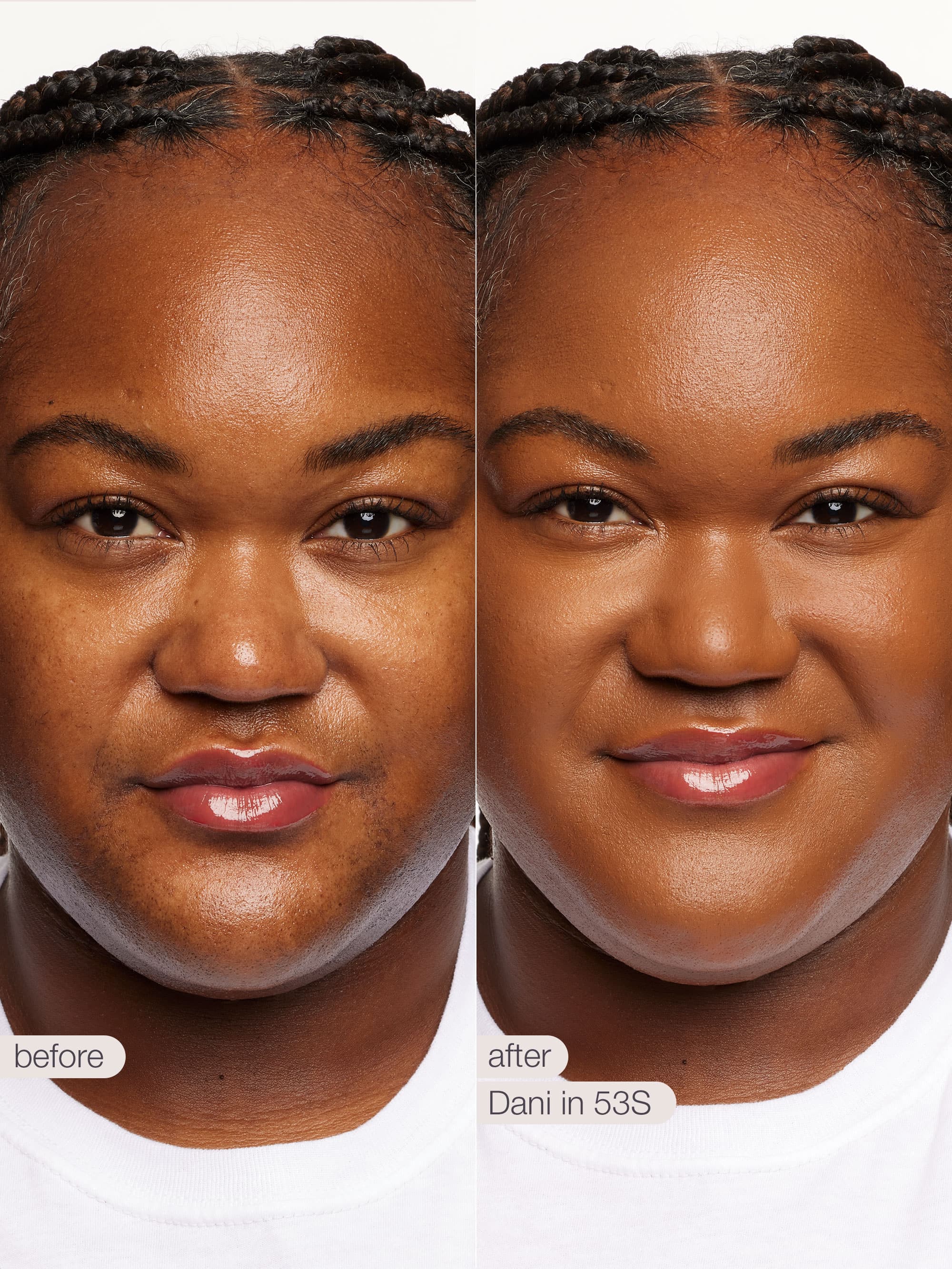 Before and after comparison of a woman's face with text indicating 'before' and 'after' on a white background.