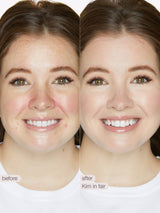 Before and after comparison of a woman's smile with cosmetic effects applied.