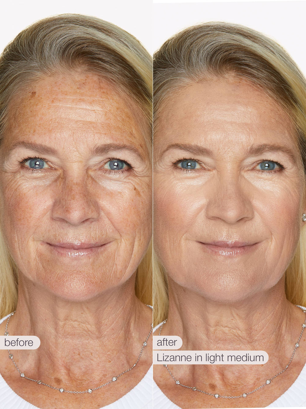 Before and after comparison of a woman's face with visible skin texture differences.